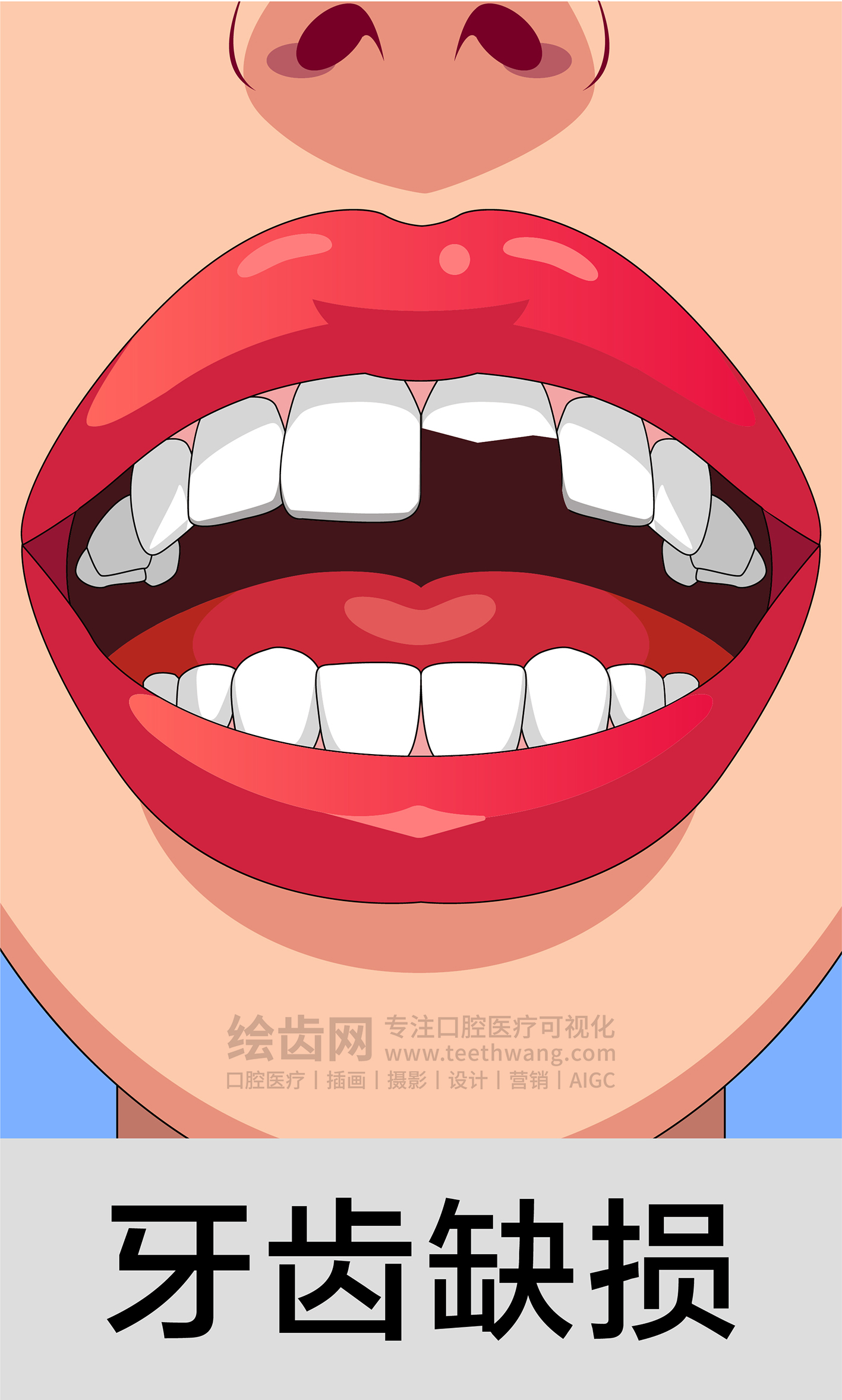 牙齿插画