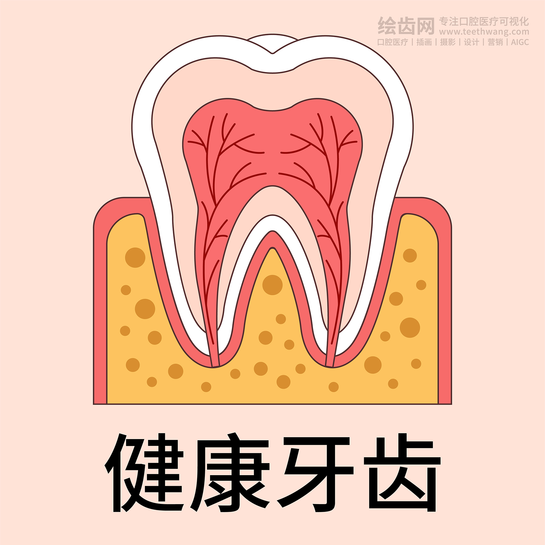 牙齿插画 龋坏过程 龋齿类型（黄色背景）