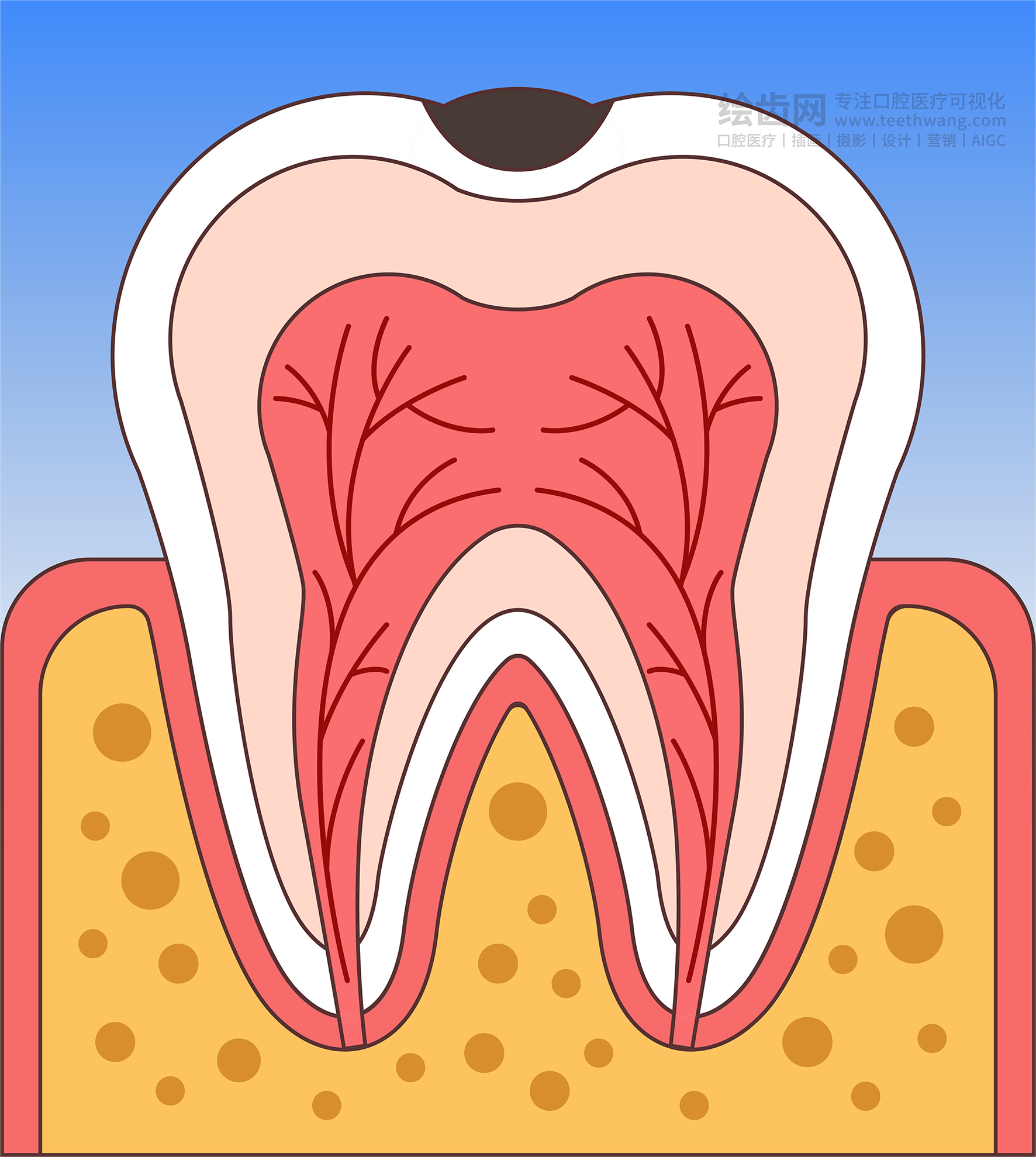 牙齿插画 龋坏过程 龋齿类型（渐变背景）