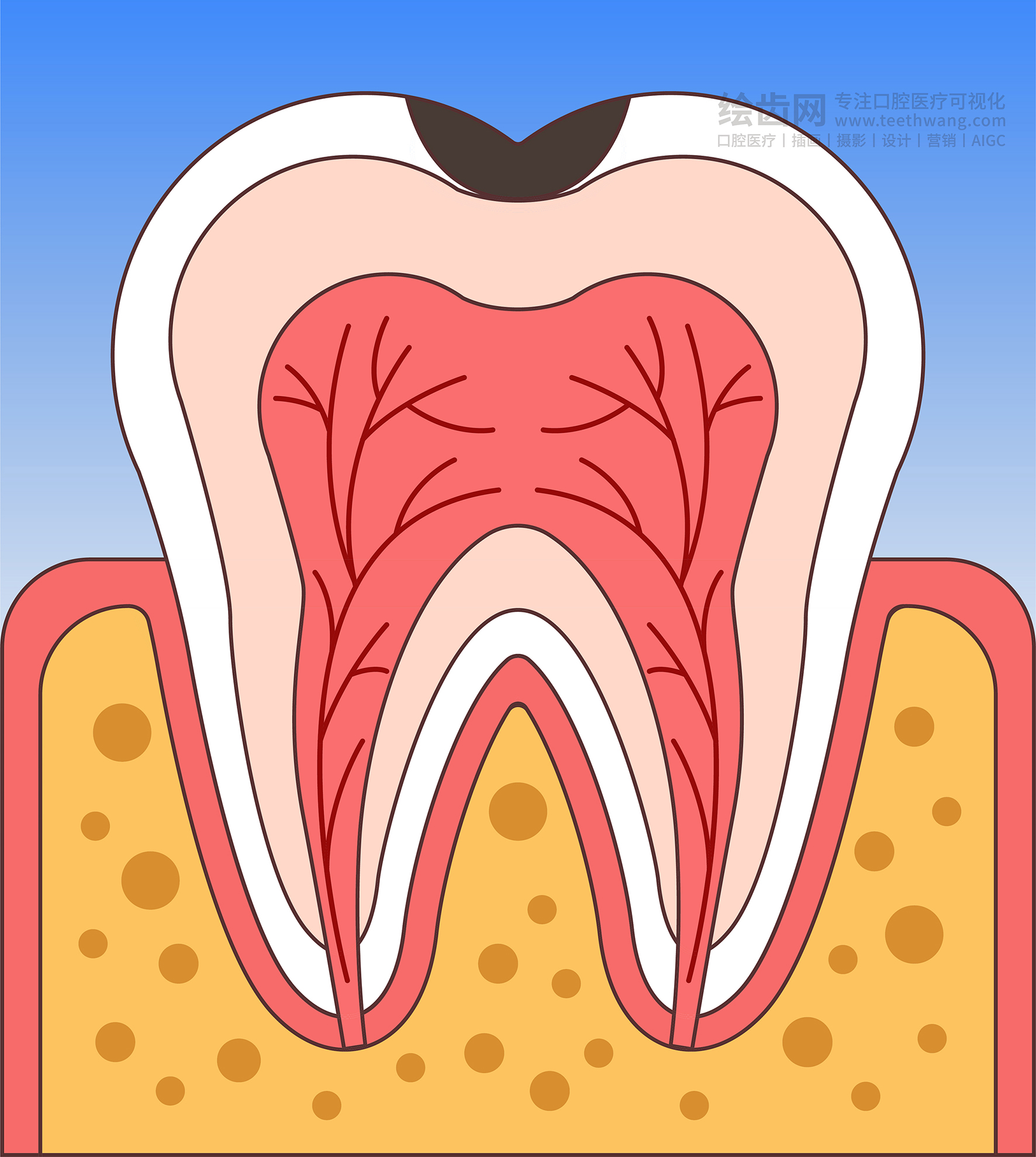 牙齿插画 龋坏过程 龋齿类型（渐变背景）