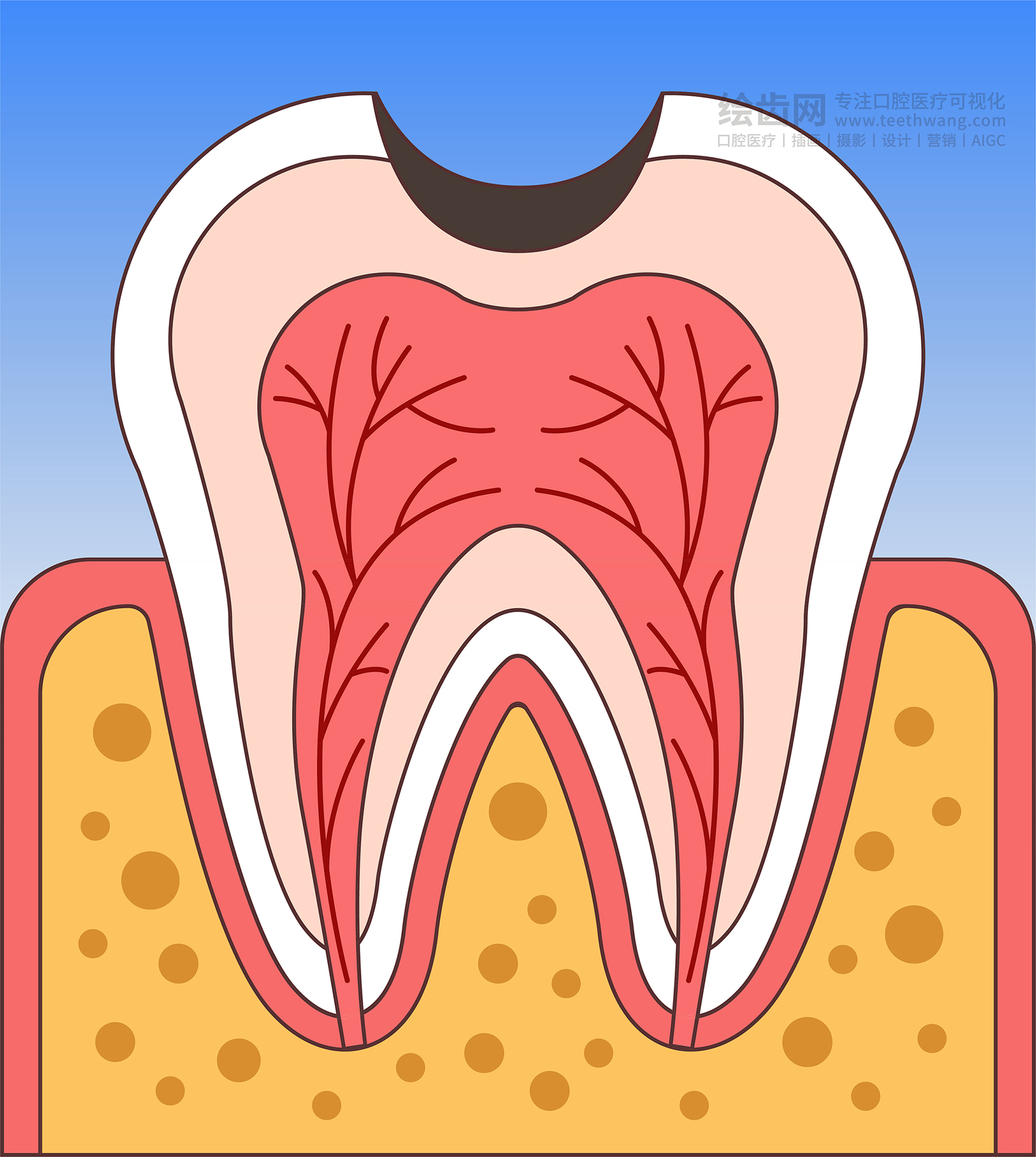 牙齿插画 龋坏过程 龋齿类型（渐变背景）