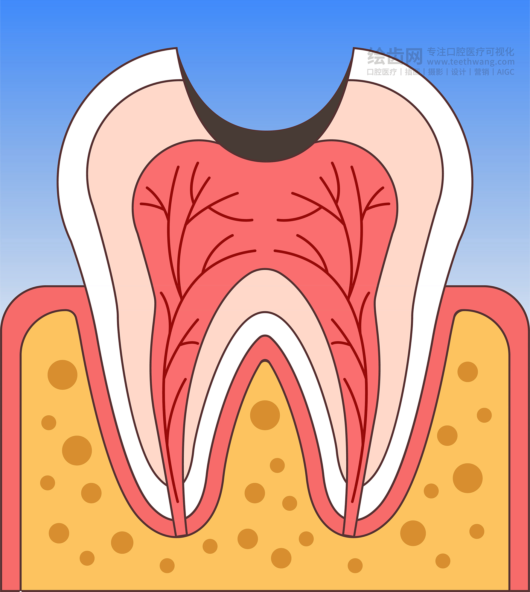 牙齿插画 龋坏过程 龋齿类型（渐变背景）