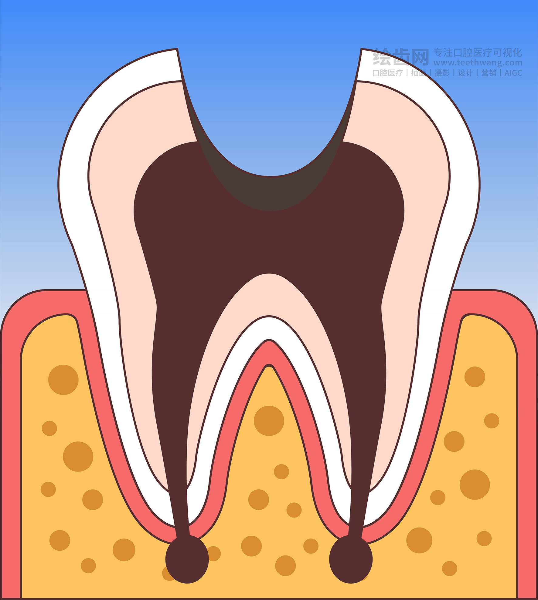 牙齿插画 龋坏过程 龋齿类型（渐变背景）