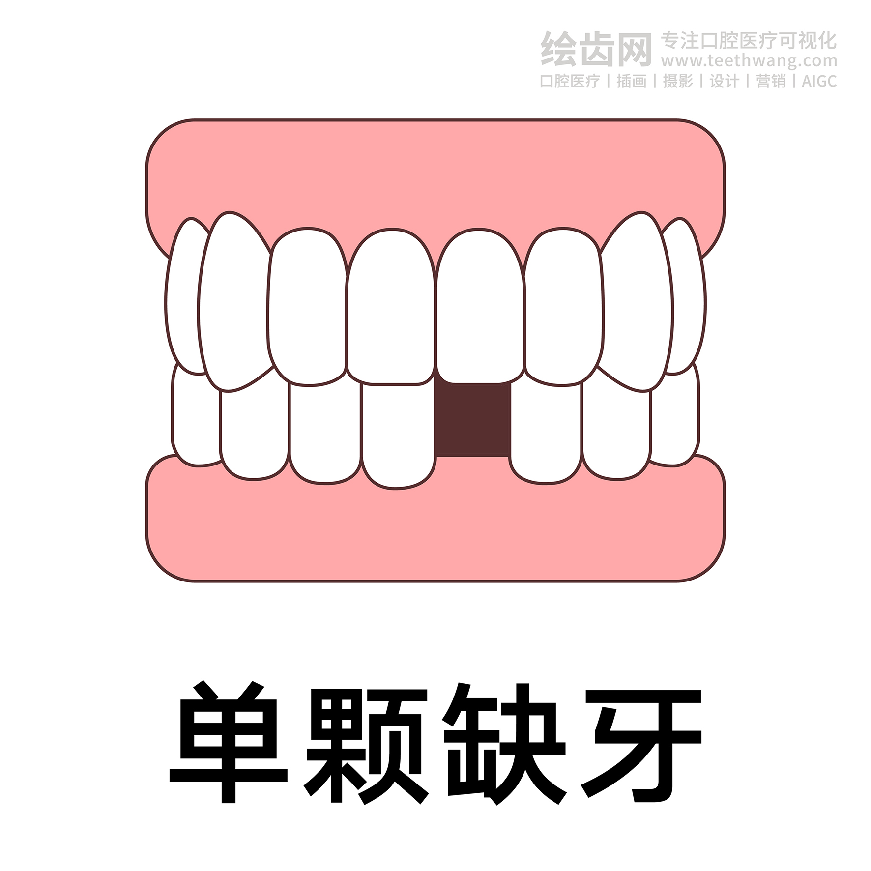 牙齿类型（合集白色） 卡通牙齿 口腔