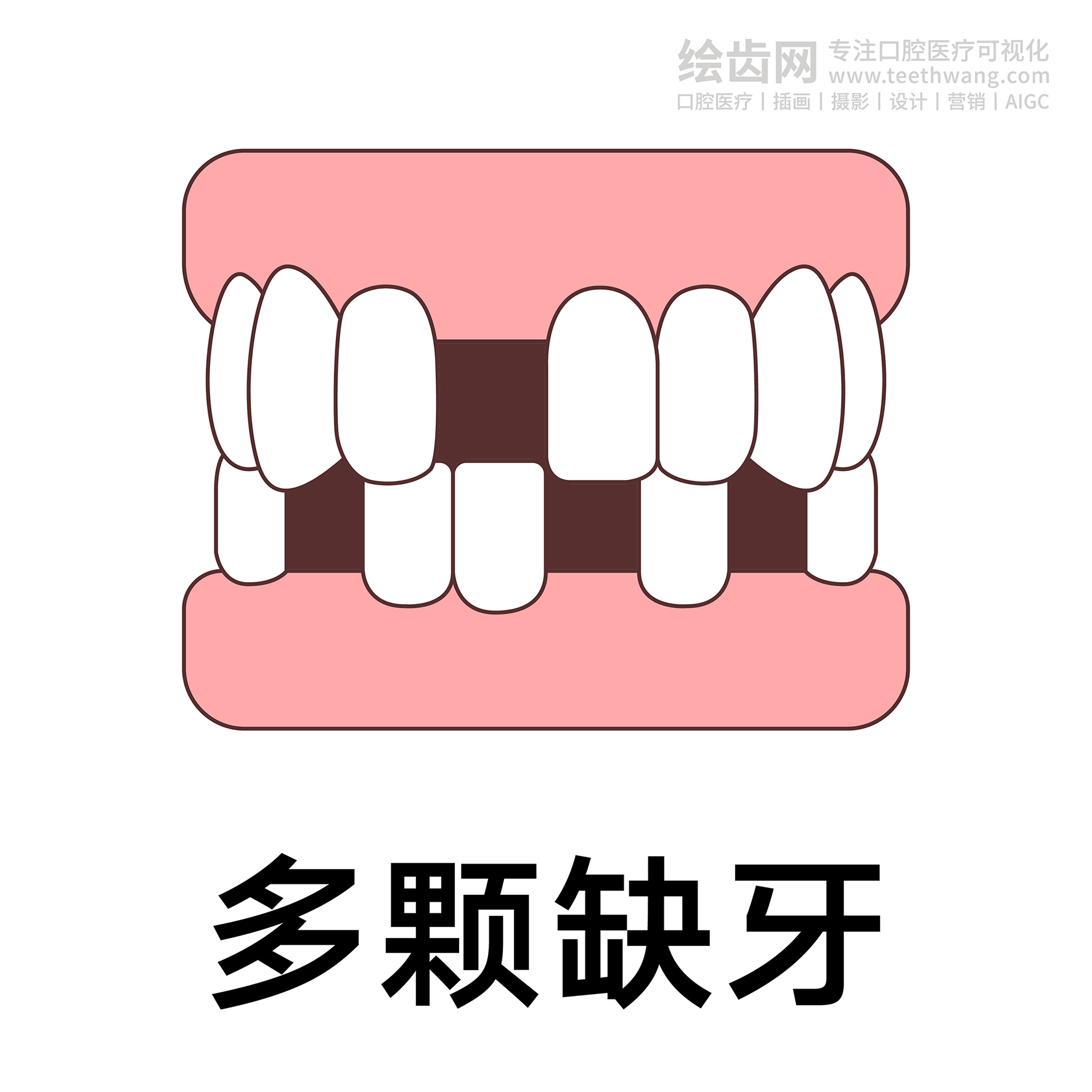 牙齿类型（合集白色） 卡通牙齿 口腔