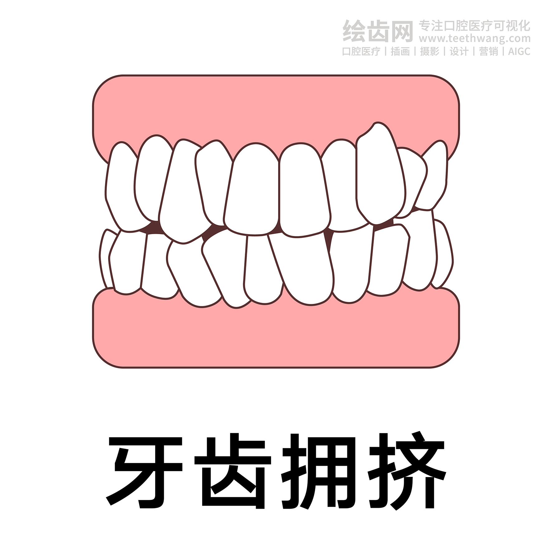 牙齿类型（合集白色） 卡通牙齿 口腔