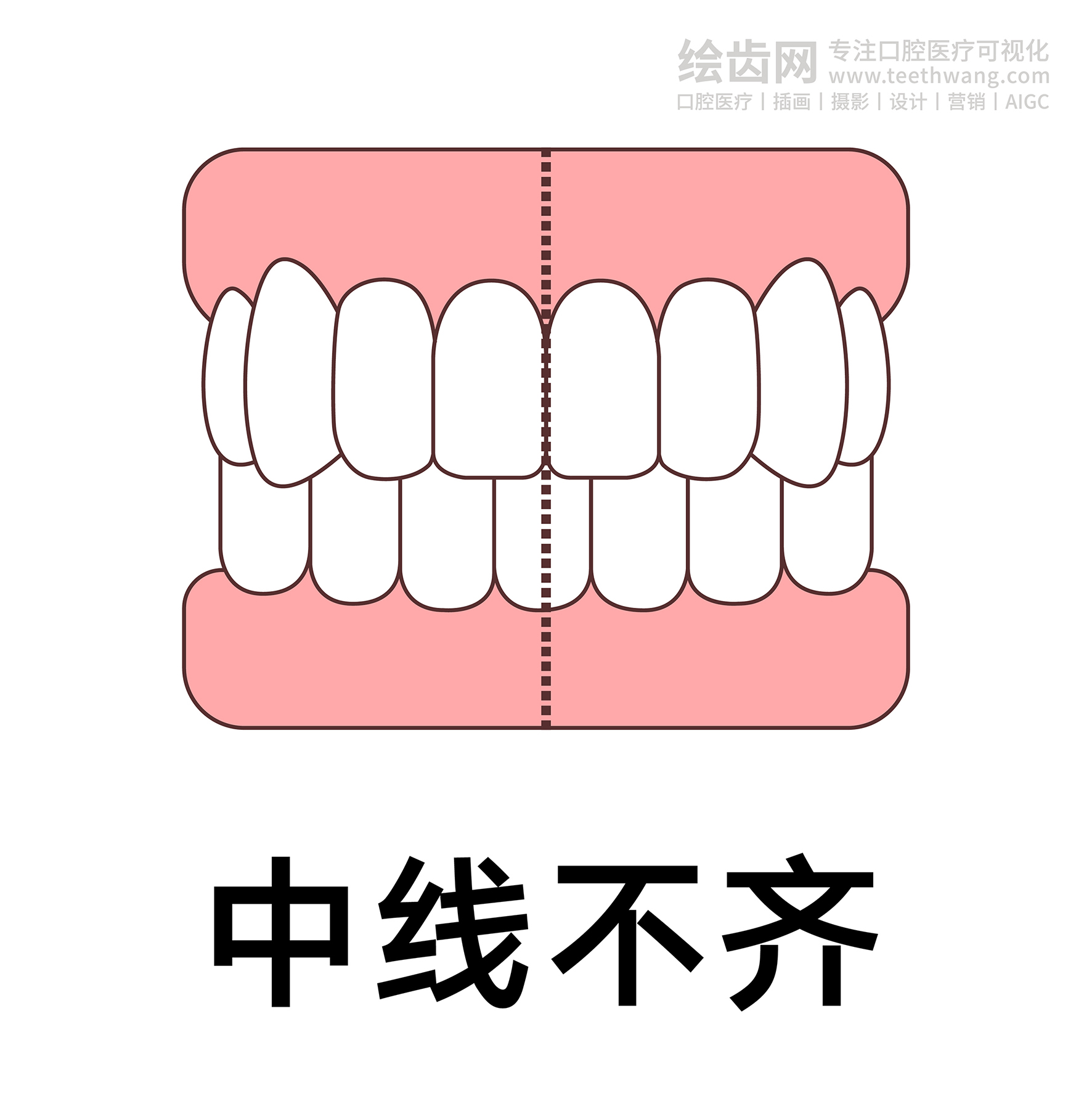 牙齿类型（合集白色） 卡通牙齿 口腔