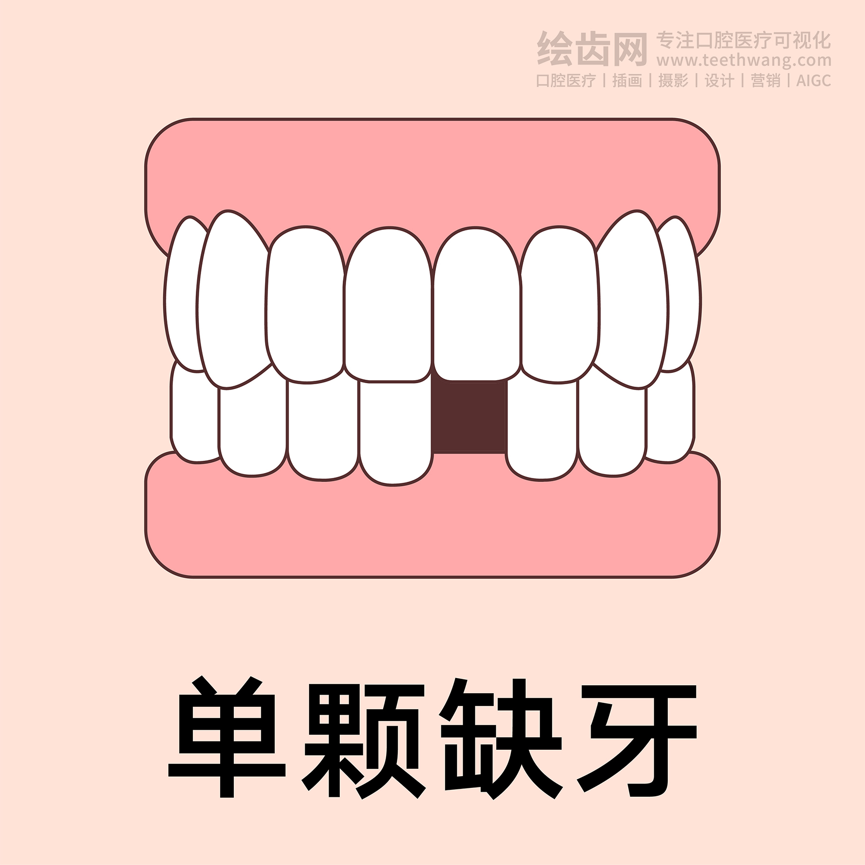 牙齿类型（合集黄色） 卡通牙齿 口腔