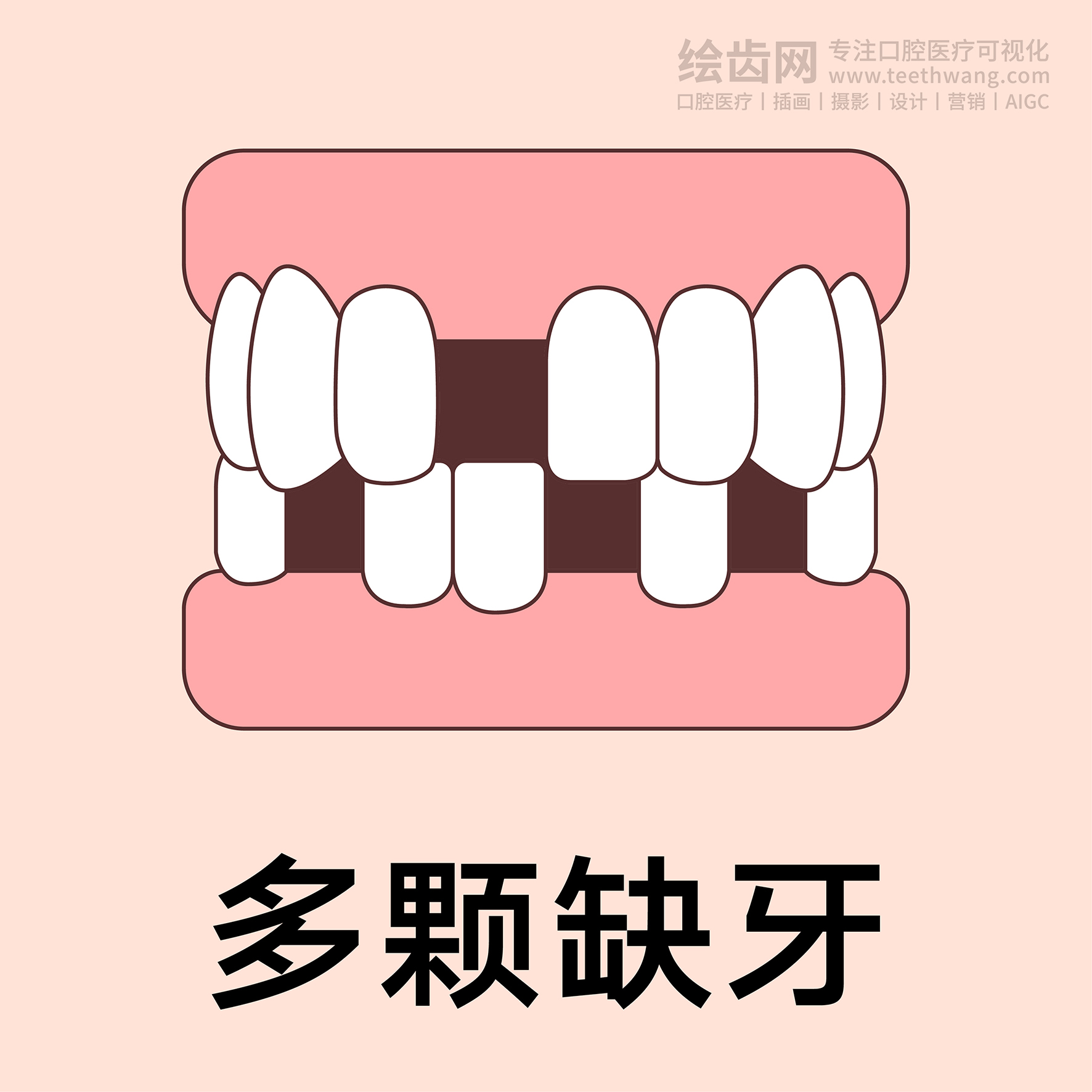 牙齿类型（合集黄色） 卡通牙齿 口腔