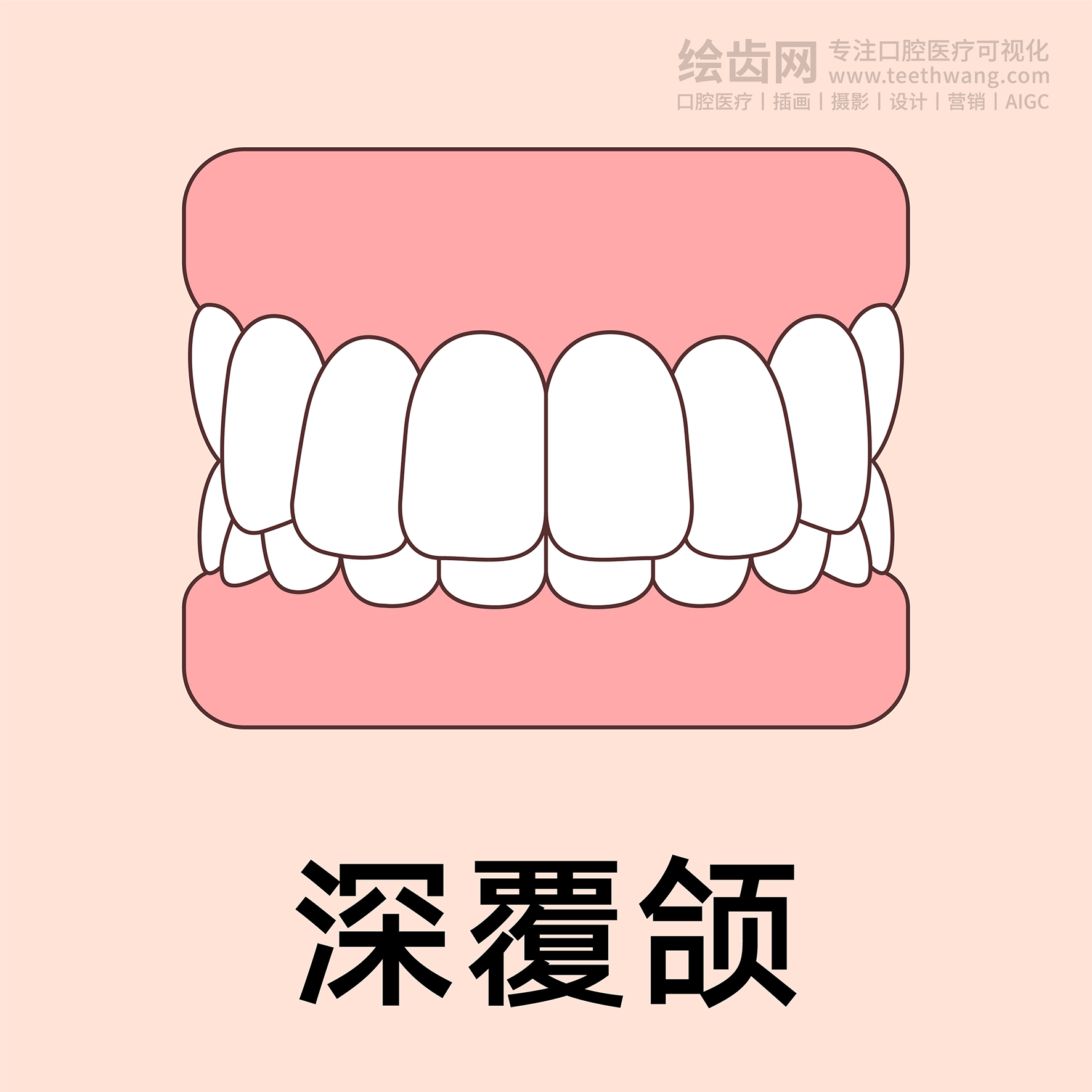 牙齿类型（合集黄色） 卡通牙齿 口腔