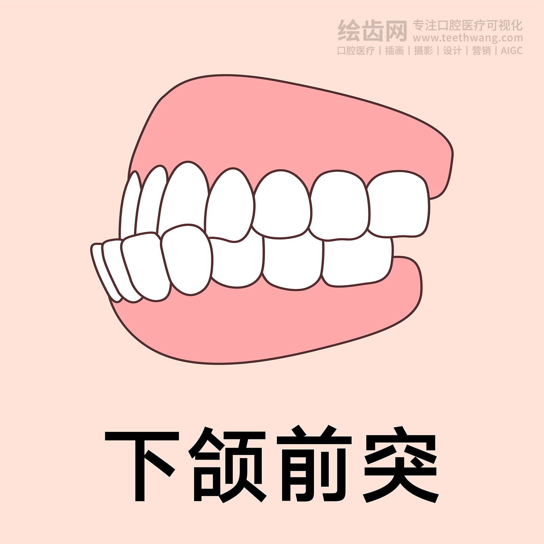 牙齿类型（合集黄色） 卡通牙齿 口腔