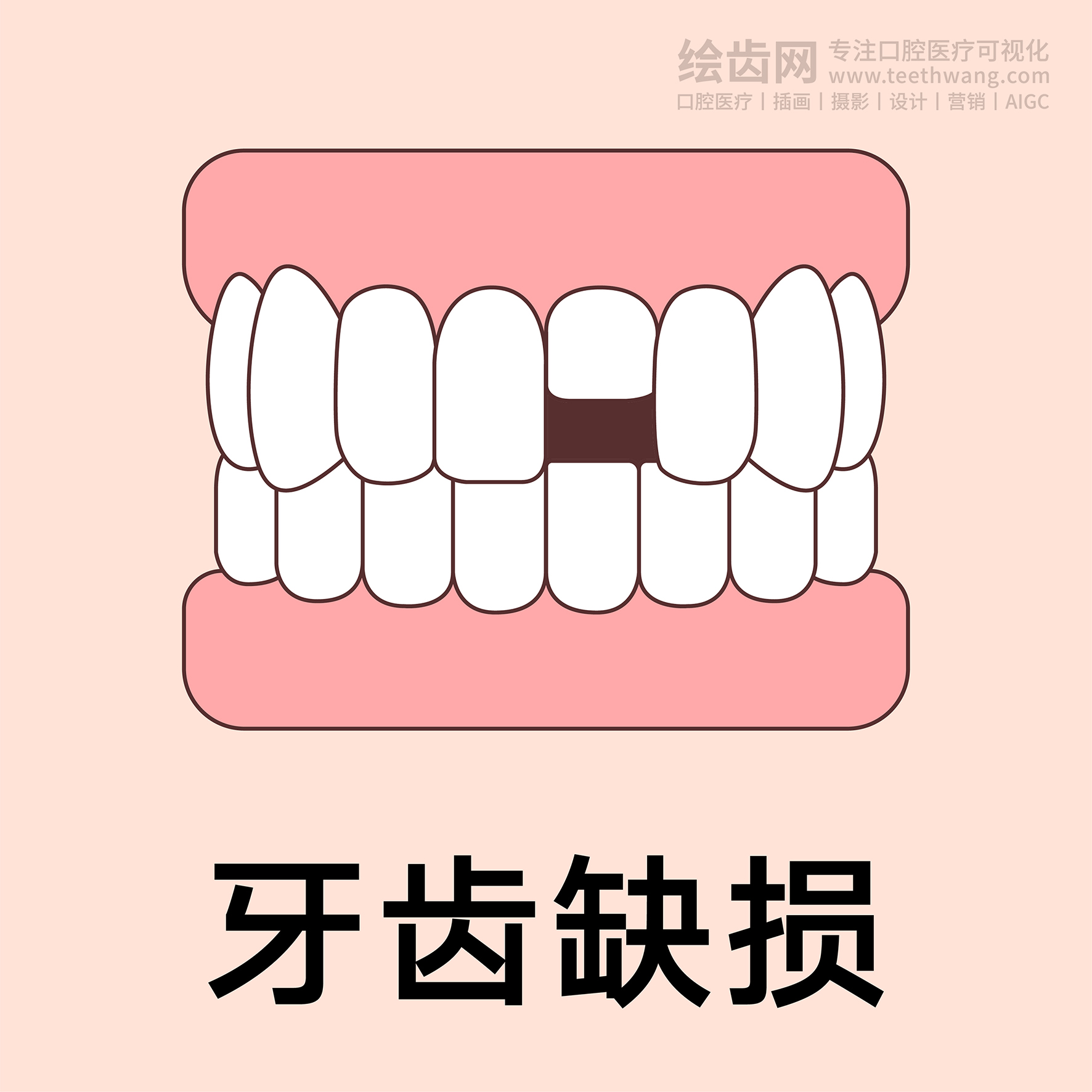 牙齿类型（合集黄色） 卡通牙齿 口腔