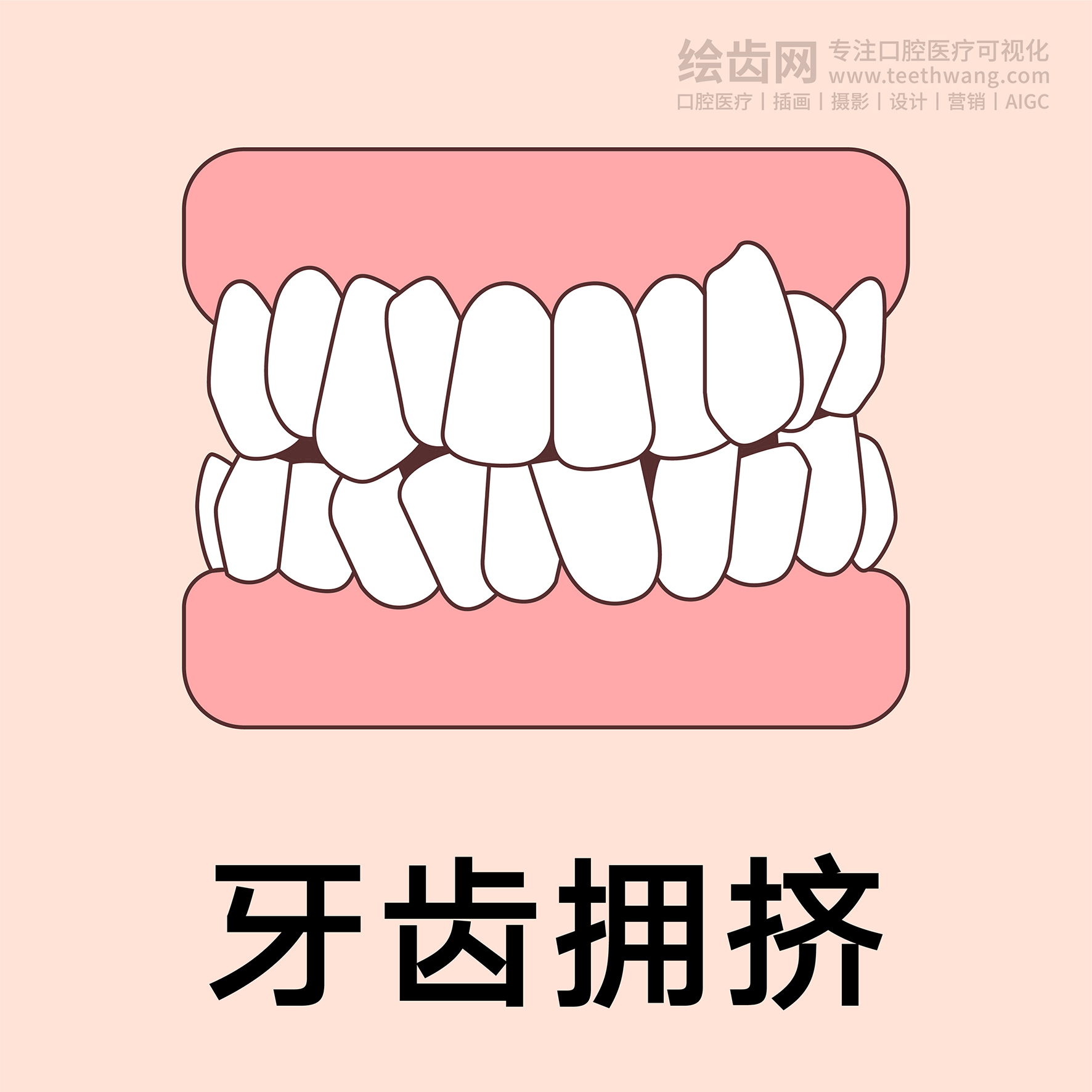 牙齿类型（合集黄色） 卡通牙齿 口腔