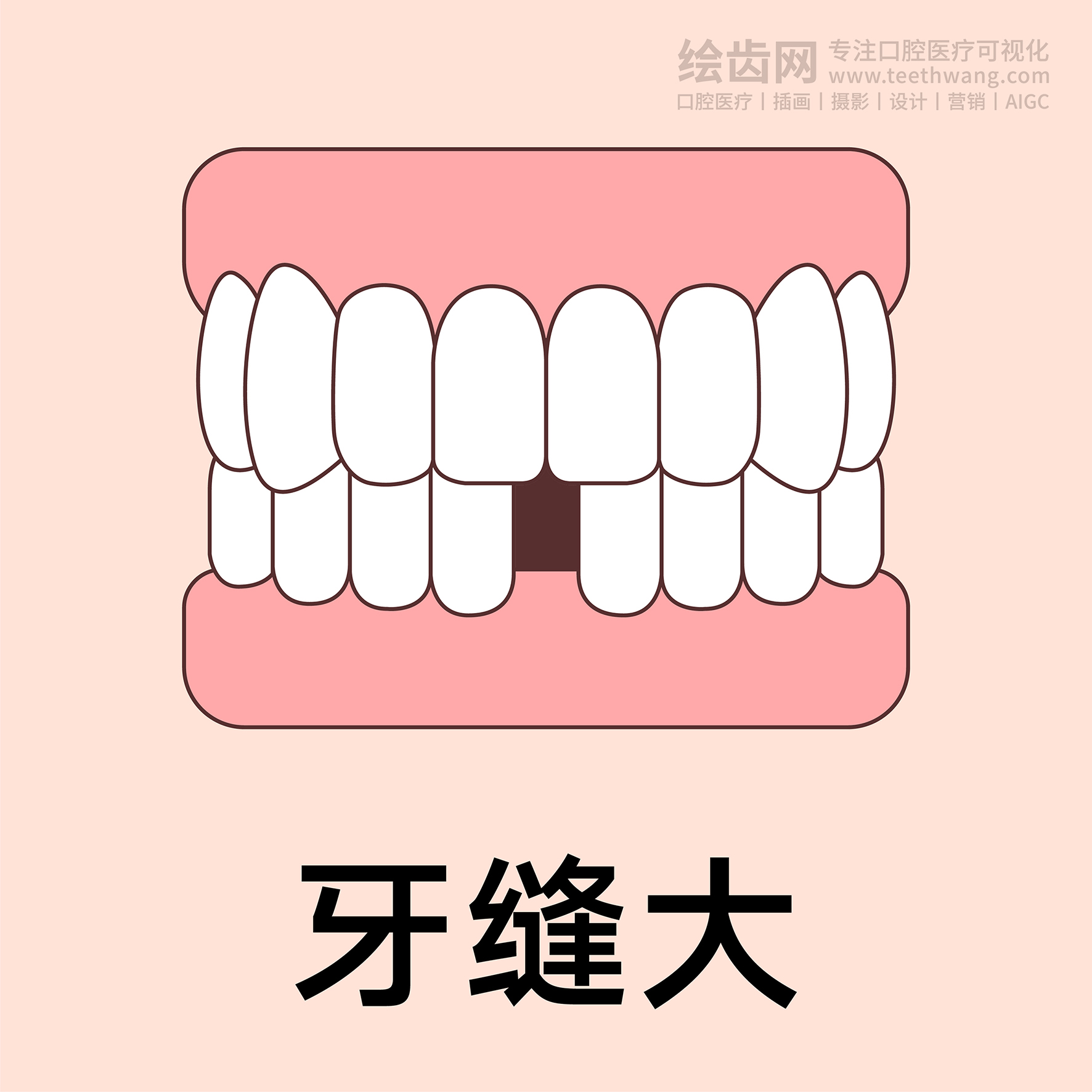 牙齿类型（合集黄色） 卡通牙齿 口腔