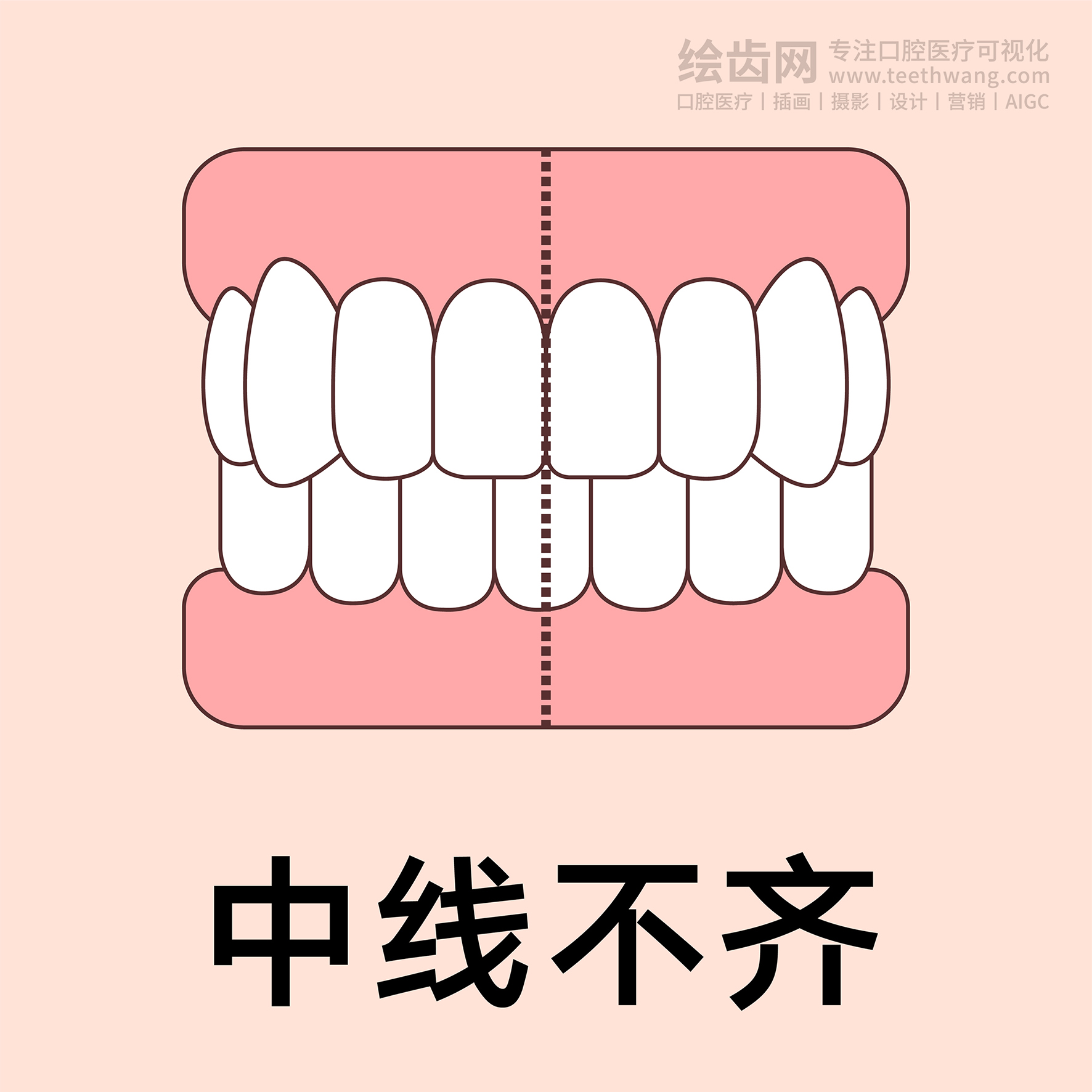 牙齿类型（合集黄色） 卡通牙齿 口腔