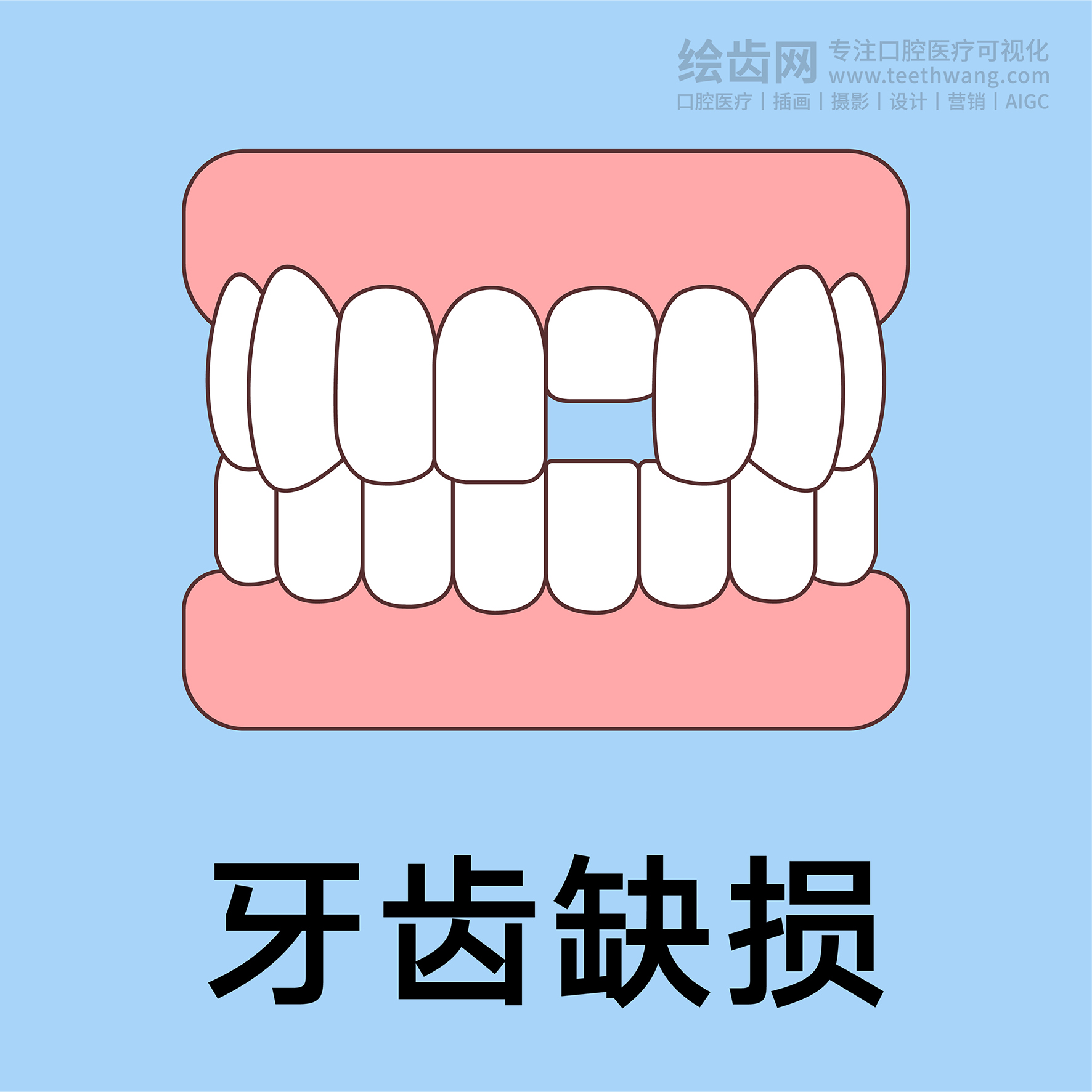 牙齿插画