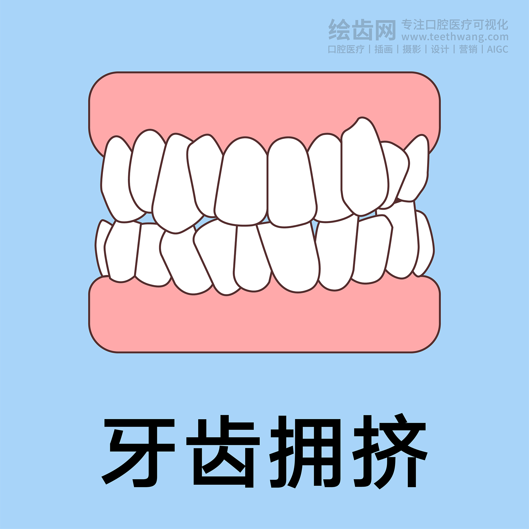 牙齿插画
