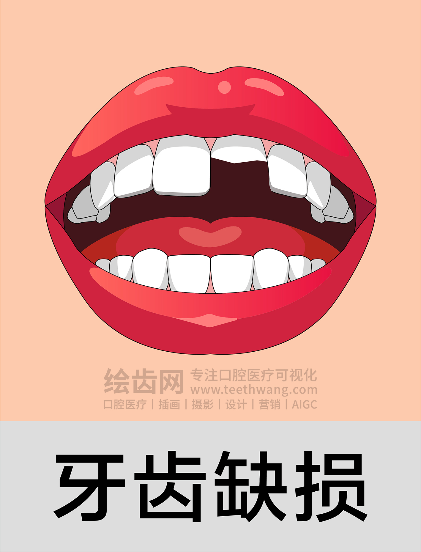 牙齿插画