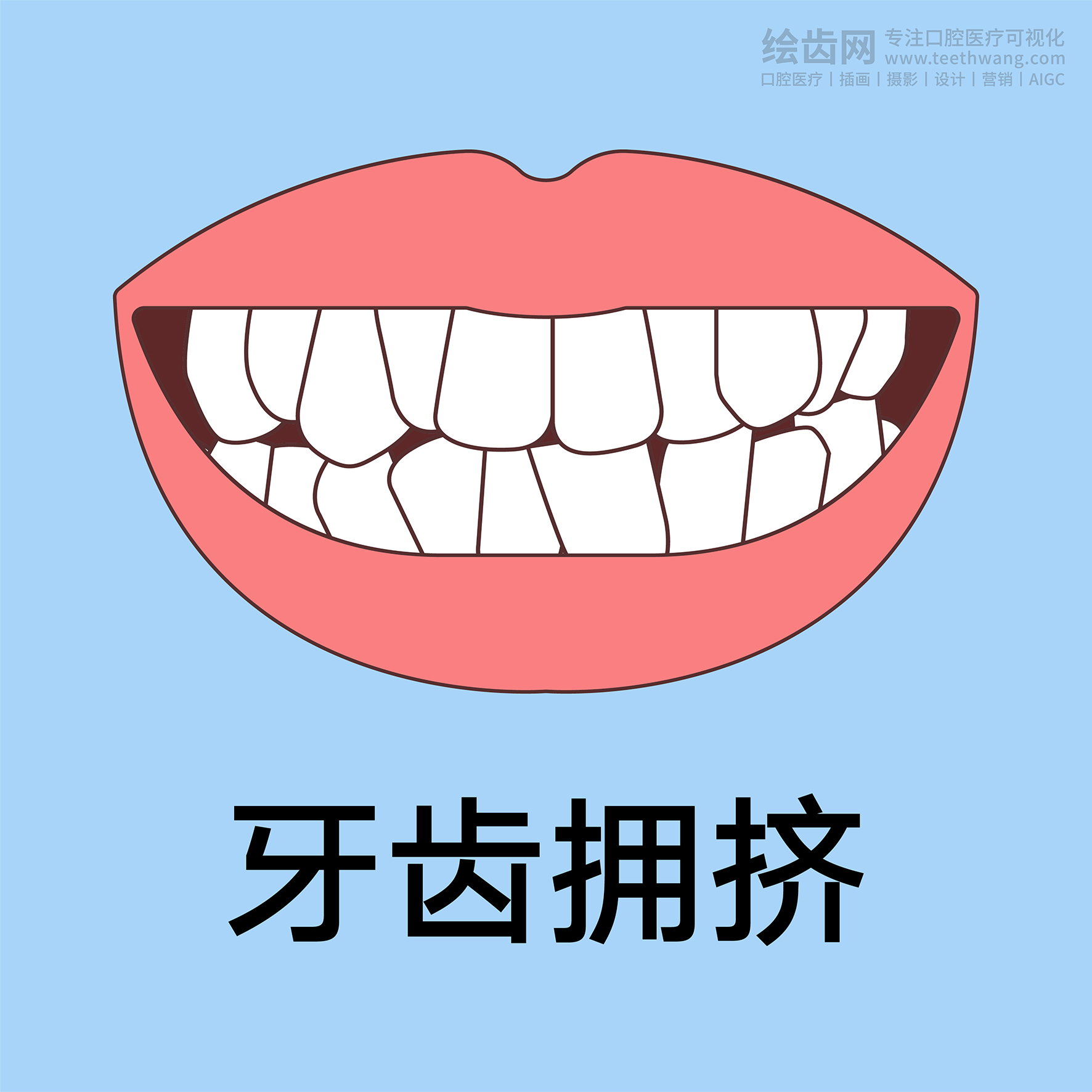 牙齿插画