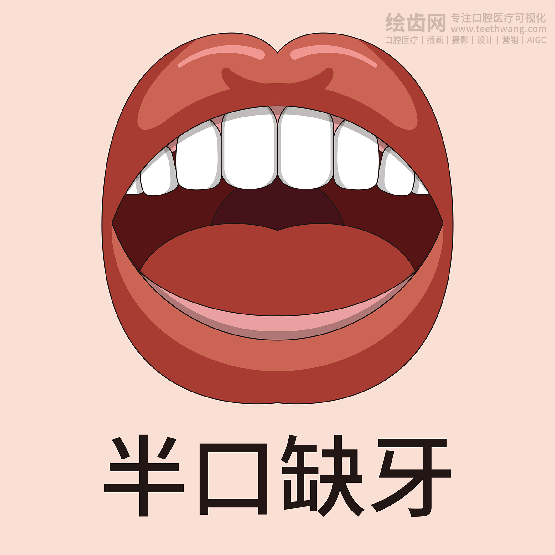 牙齿类型大全（合集-黄色背景）牙齿矫正 种植 贴面