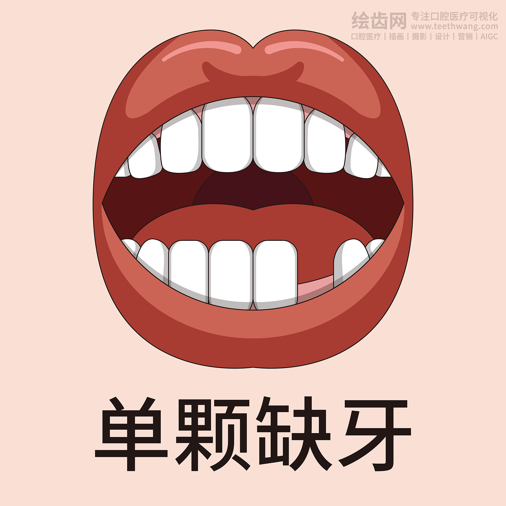 牙齿类型大全（合集-黄色背景）牙齿矫正 种植 贴面