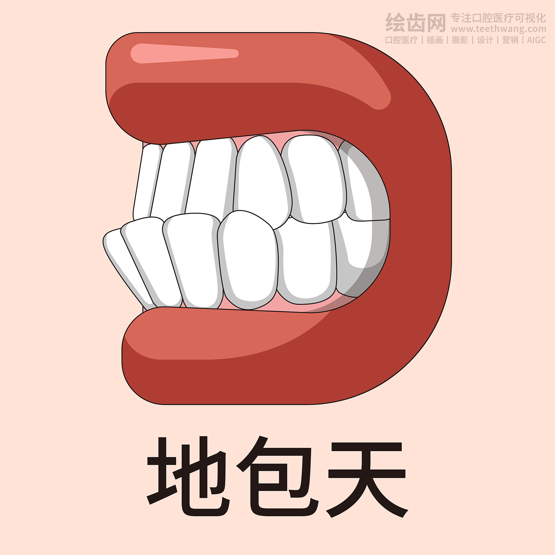 牙齿类型大全（合集-黄色背景）牙齿矫正 种植 贴面