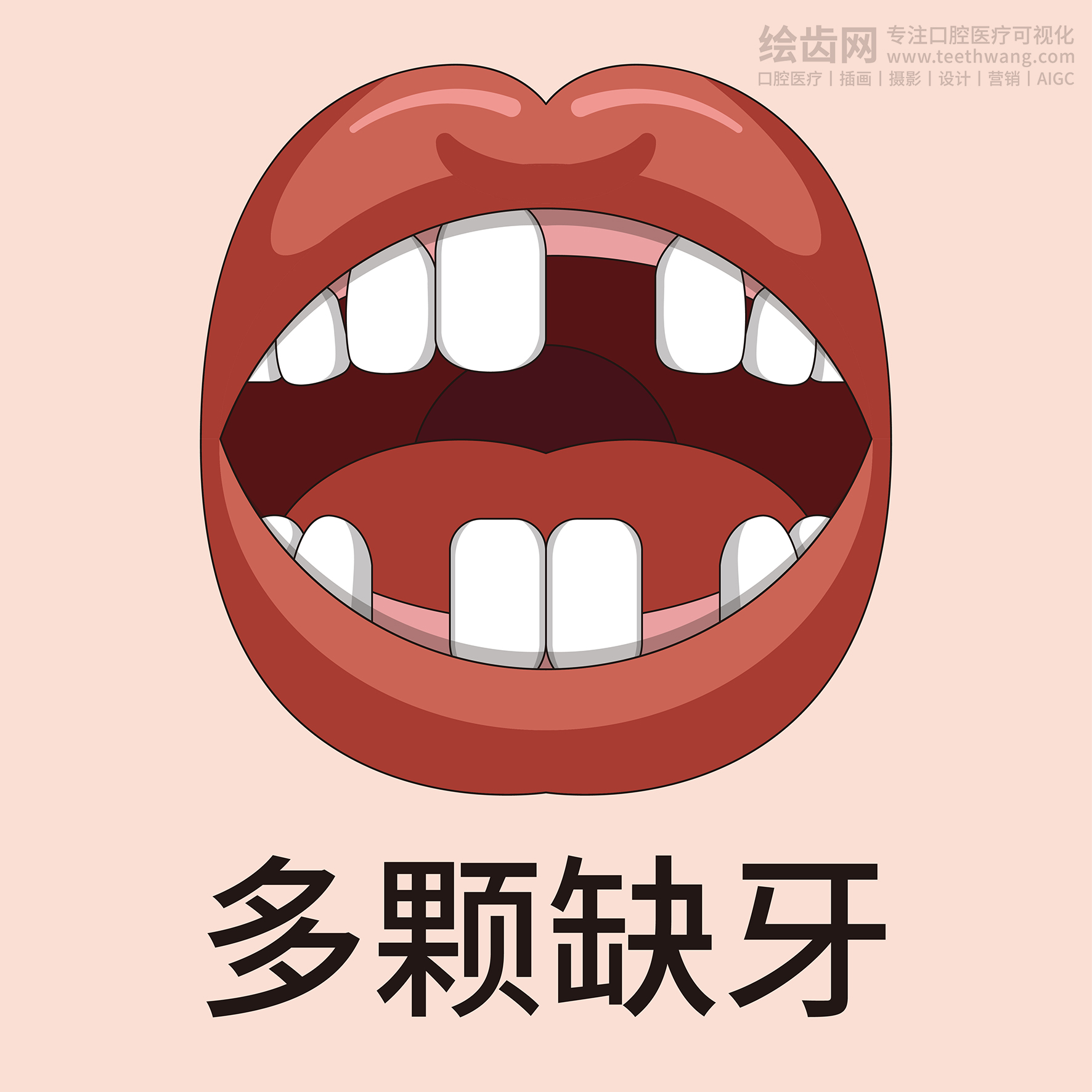 牙齿类型大全（合集-黄色背景）牙齿矫正 种植 贴面