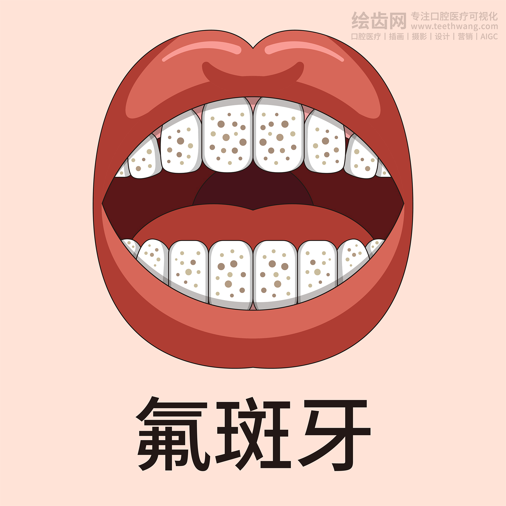 牙齿类型大全（合集-黄色背景）牙齿矫正 种植 贴面