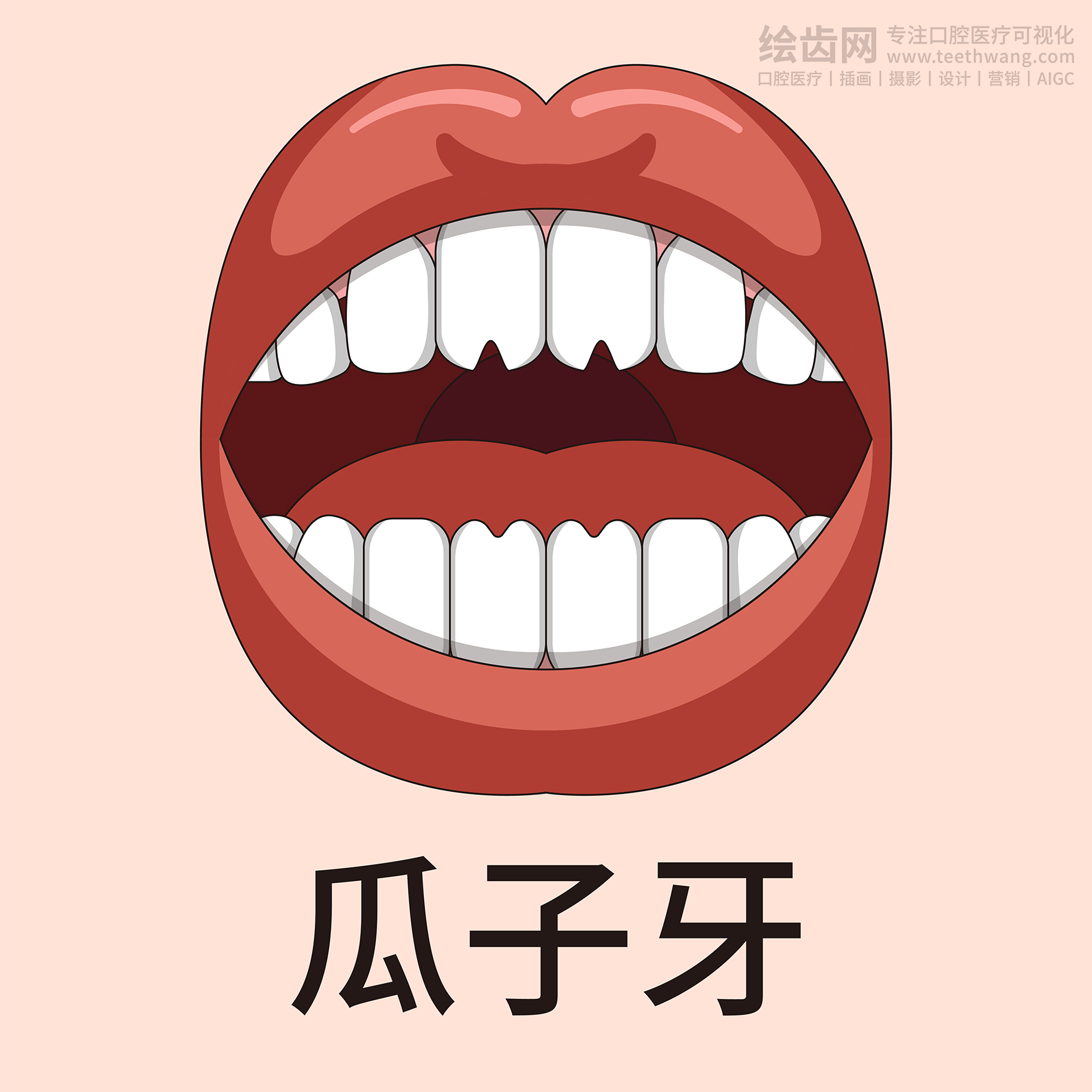 牙齿类型大全（合集-黄色背景）牙齿矫正 种植 贴面