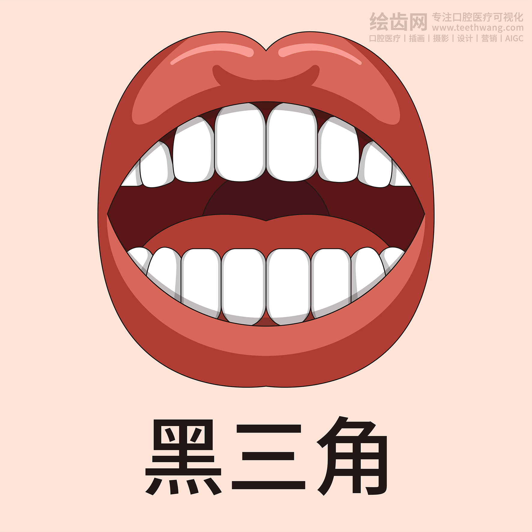 牙齿类型大全（合集-黄色背景）牙齿矫正 种植 贴面