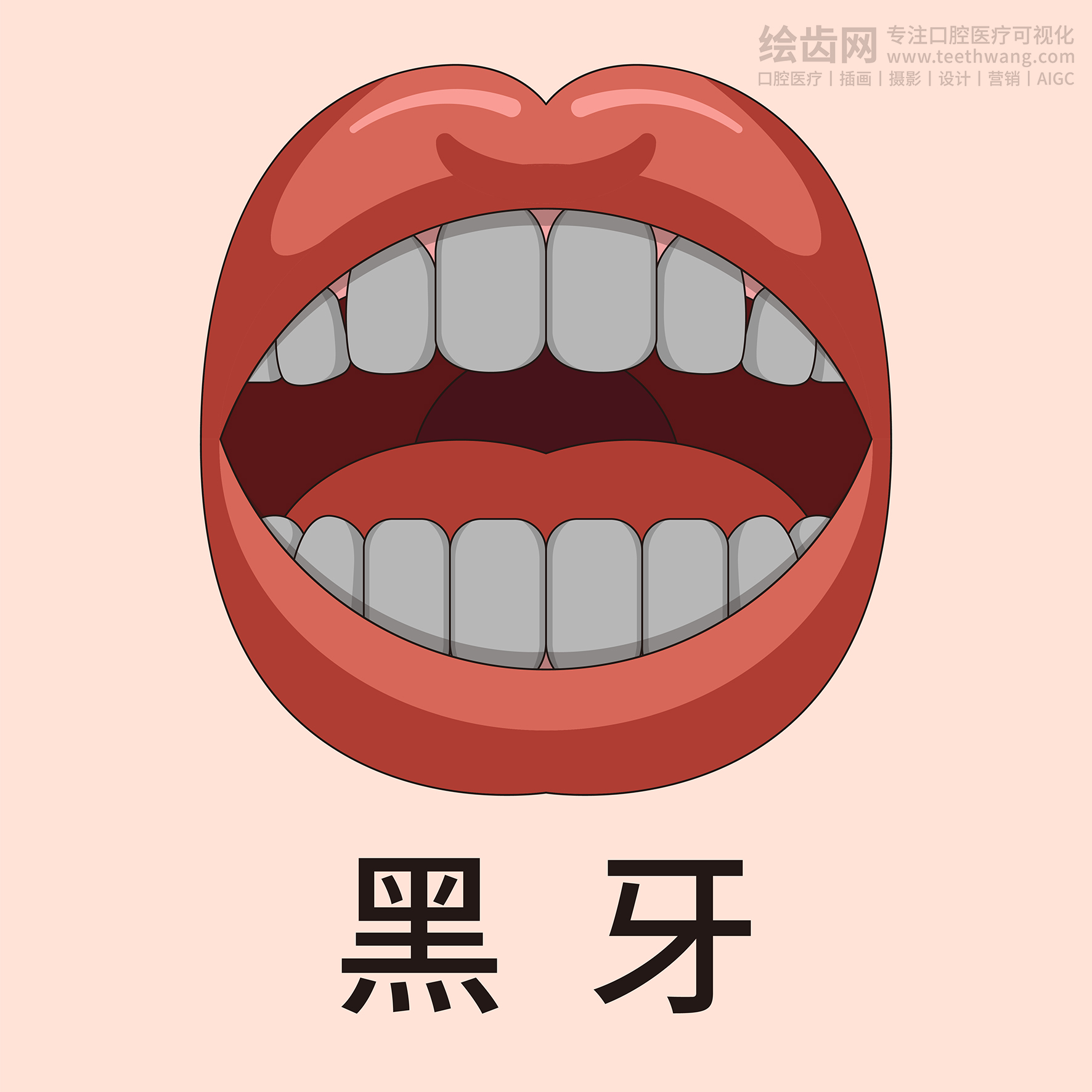 牙齿类型大全（合集-黄色背景）牙齿矫正 种植 贴面