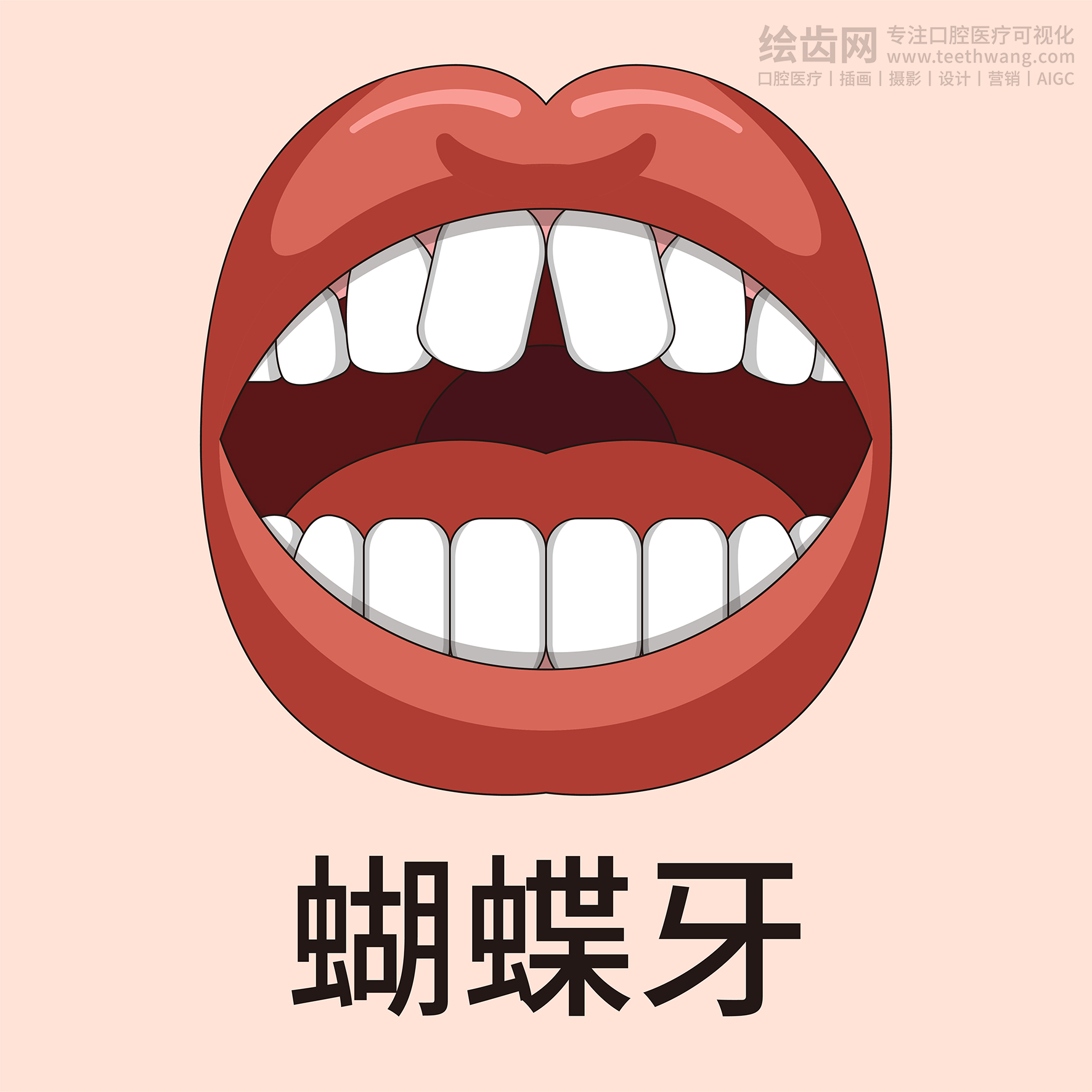 牙齿类型大全（合集-黄色背景）牙齿矫正 种植 贴面