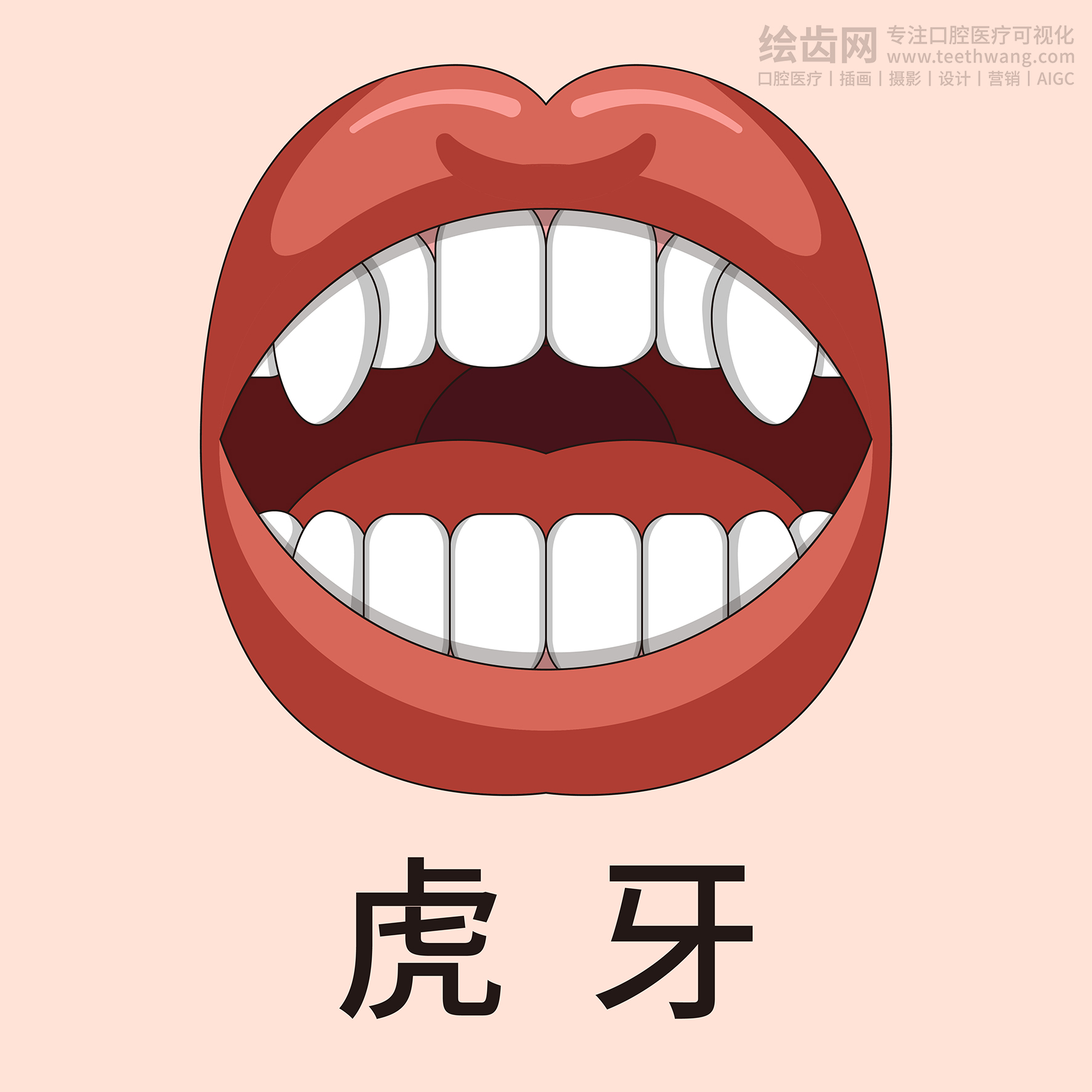 牙齿类型大全（合集-黄色背景）牙齿矫正 种植 贴面