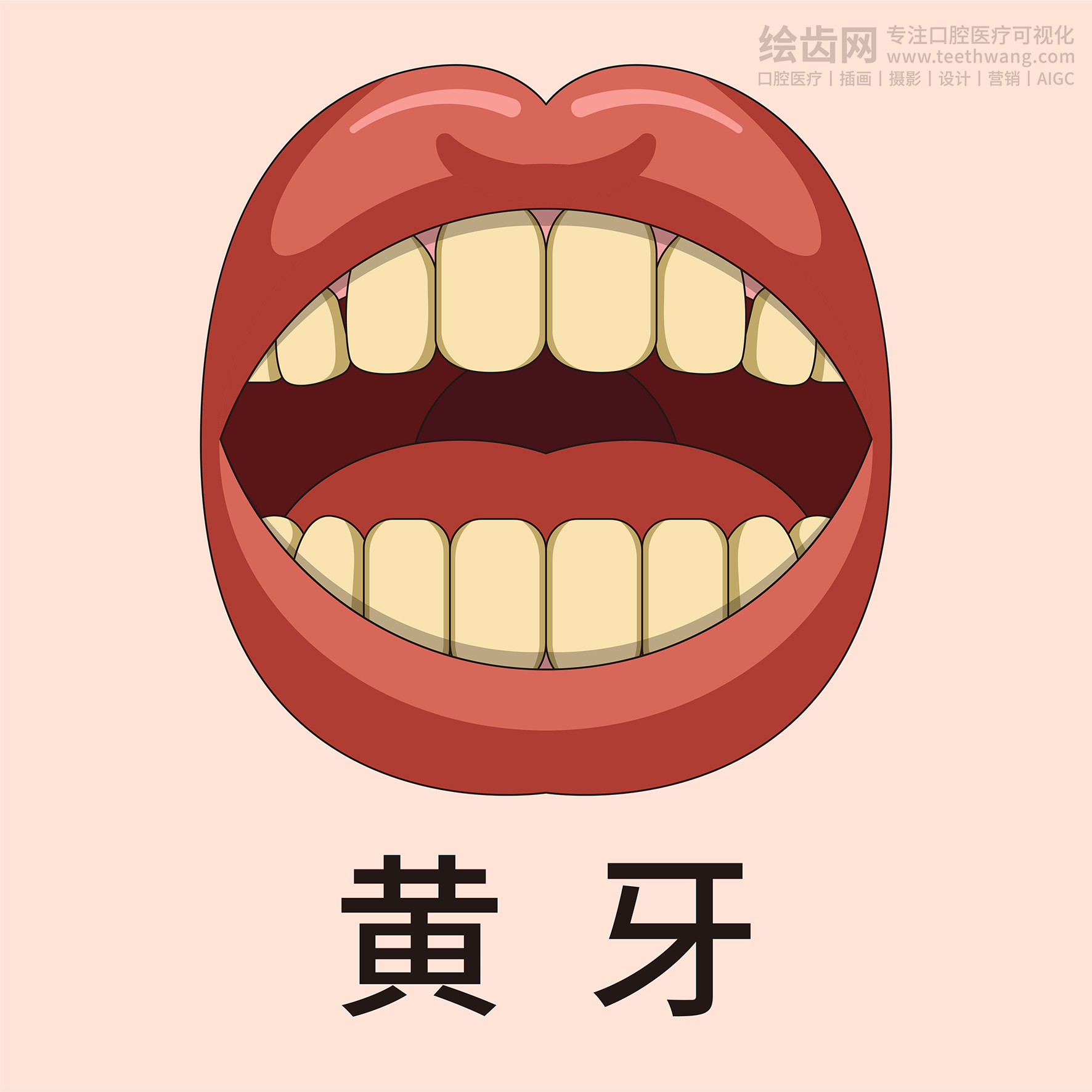 牙齿类型大全（合集-黄色背景）牙齿矫正 种植 贴面