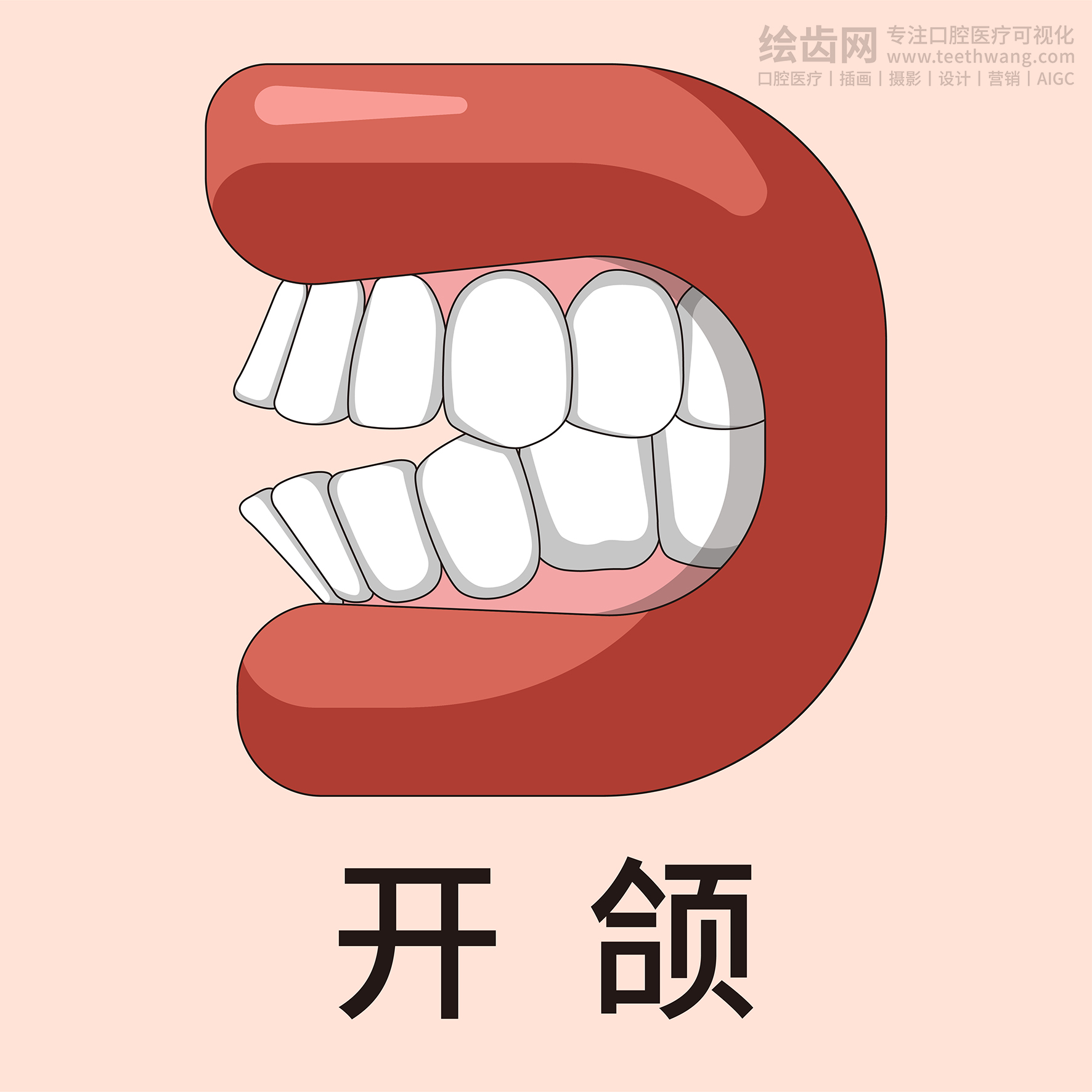 牙齿类型大全（合集-黄色背景）牙齿矫正 种植 贴面