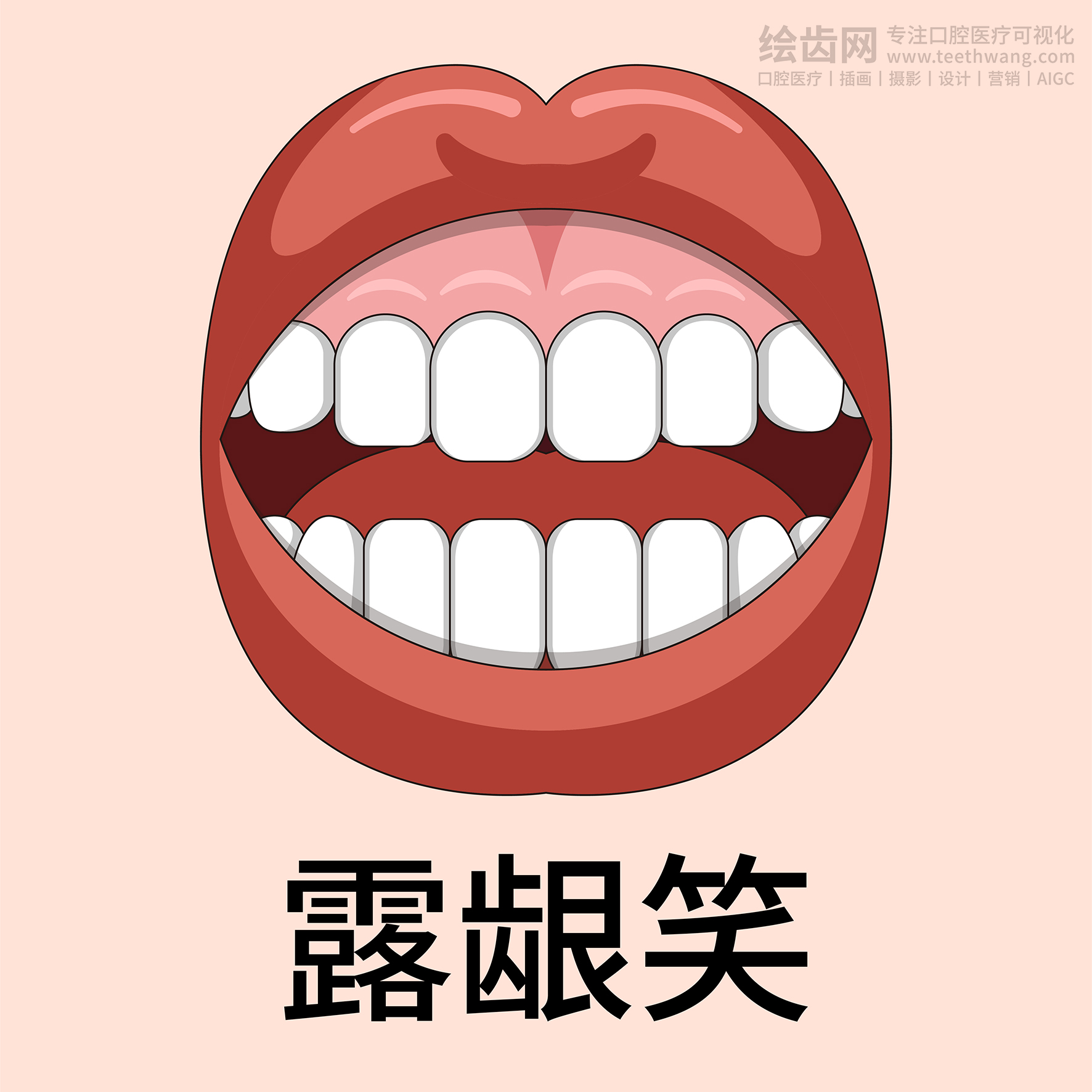 牙齿类型大全（合集-黄色背景）牙齿矫正 种植 贴面