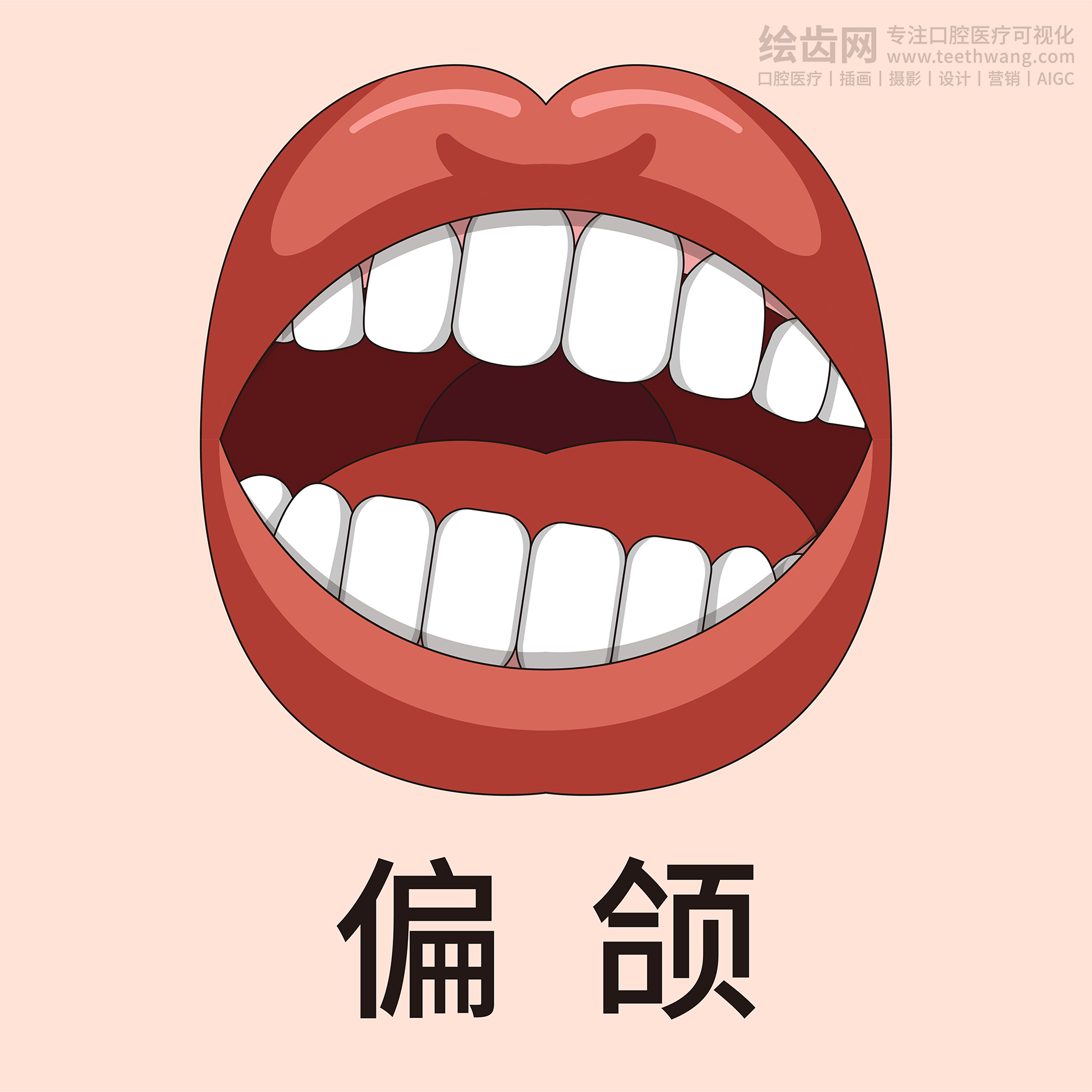 牙齿类型大全（合集-黄色背景）牙齿矫正 种植 贴面