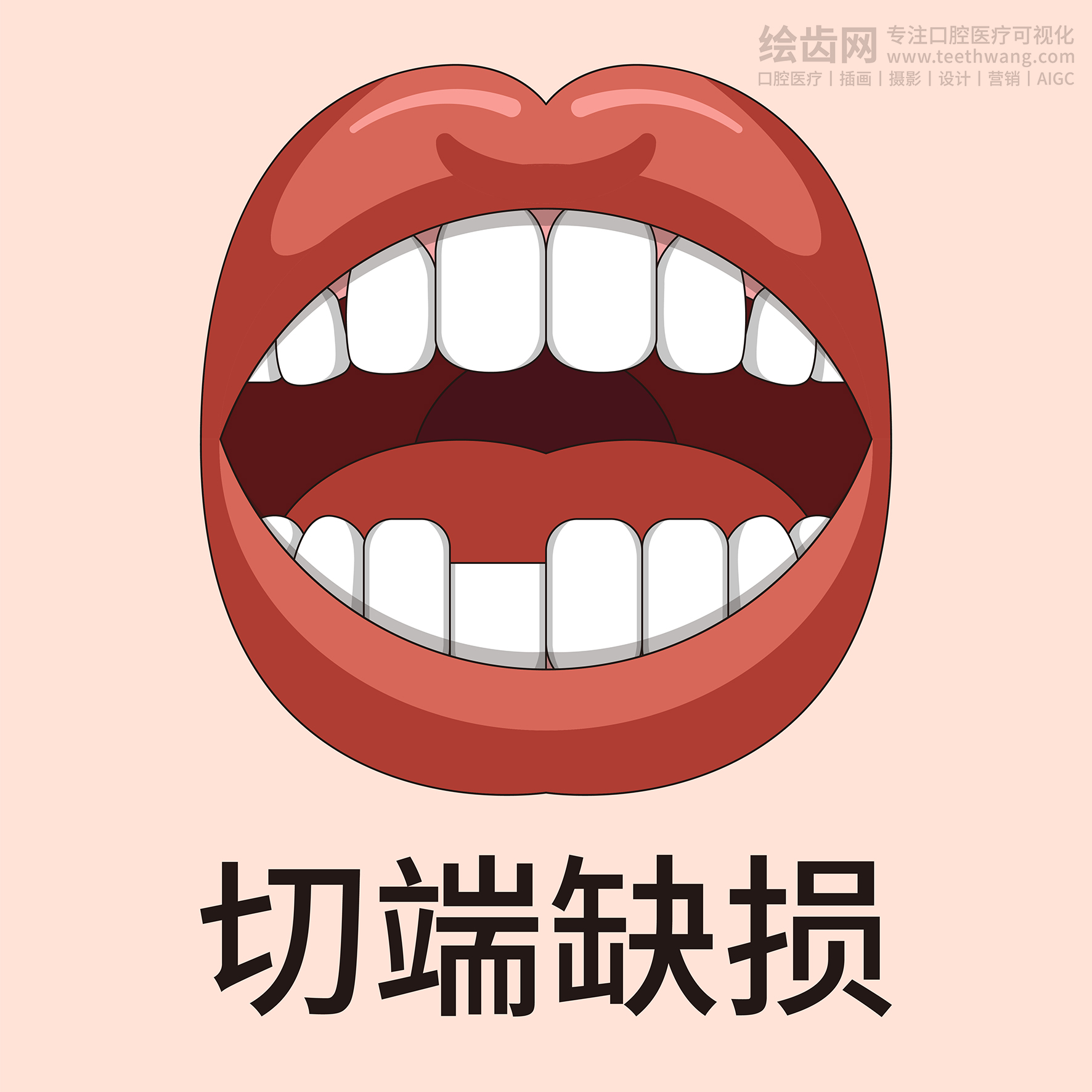 牙齿类型大全（合集-黄色背景）牙齿矫正 种植 贴面