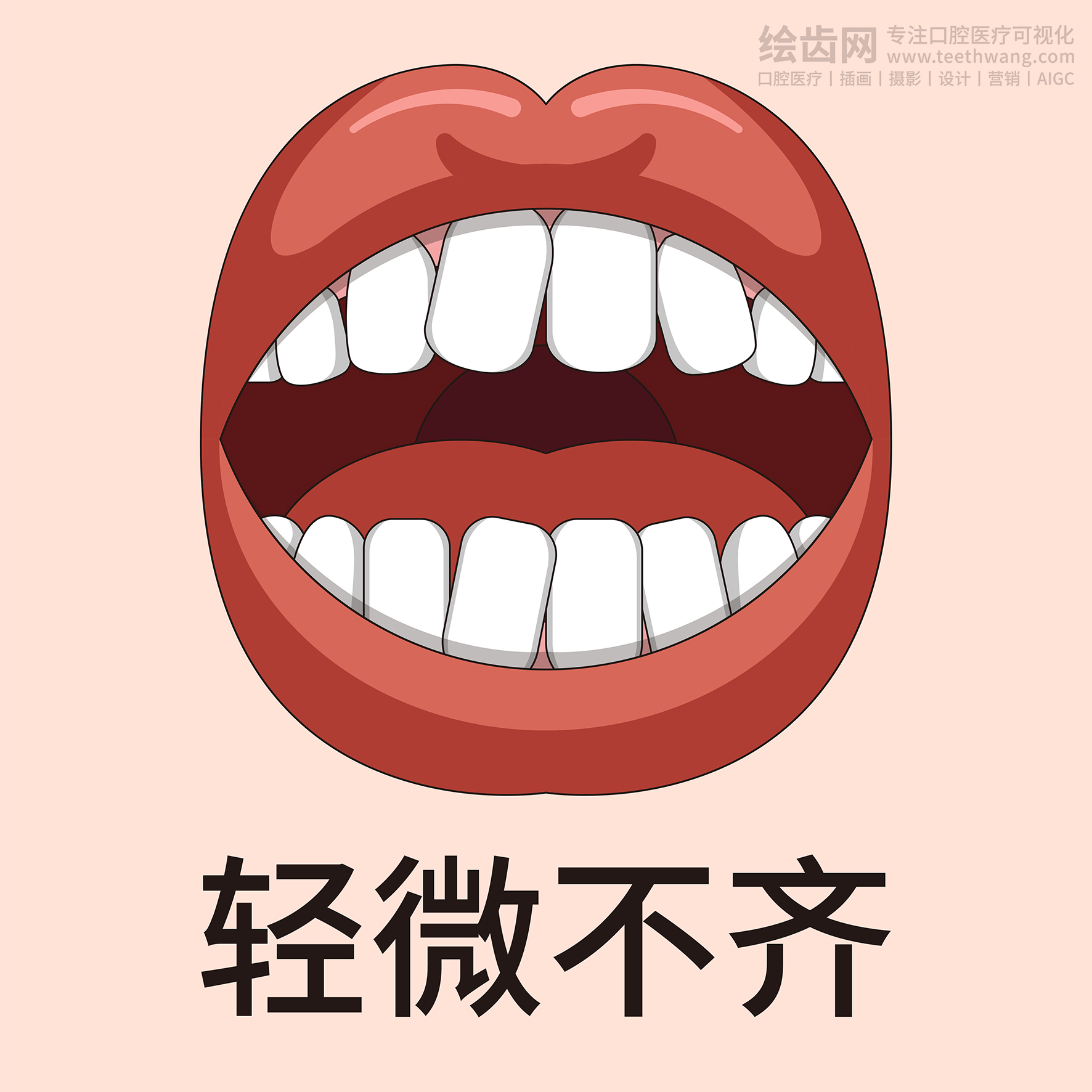 牙齿类型大全（合集-黄色背景）牙齿矫正 种植 贴面