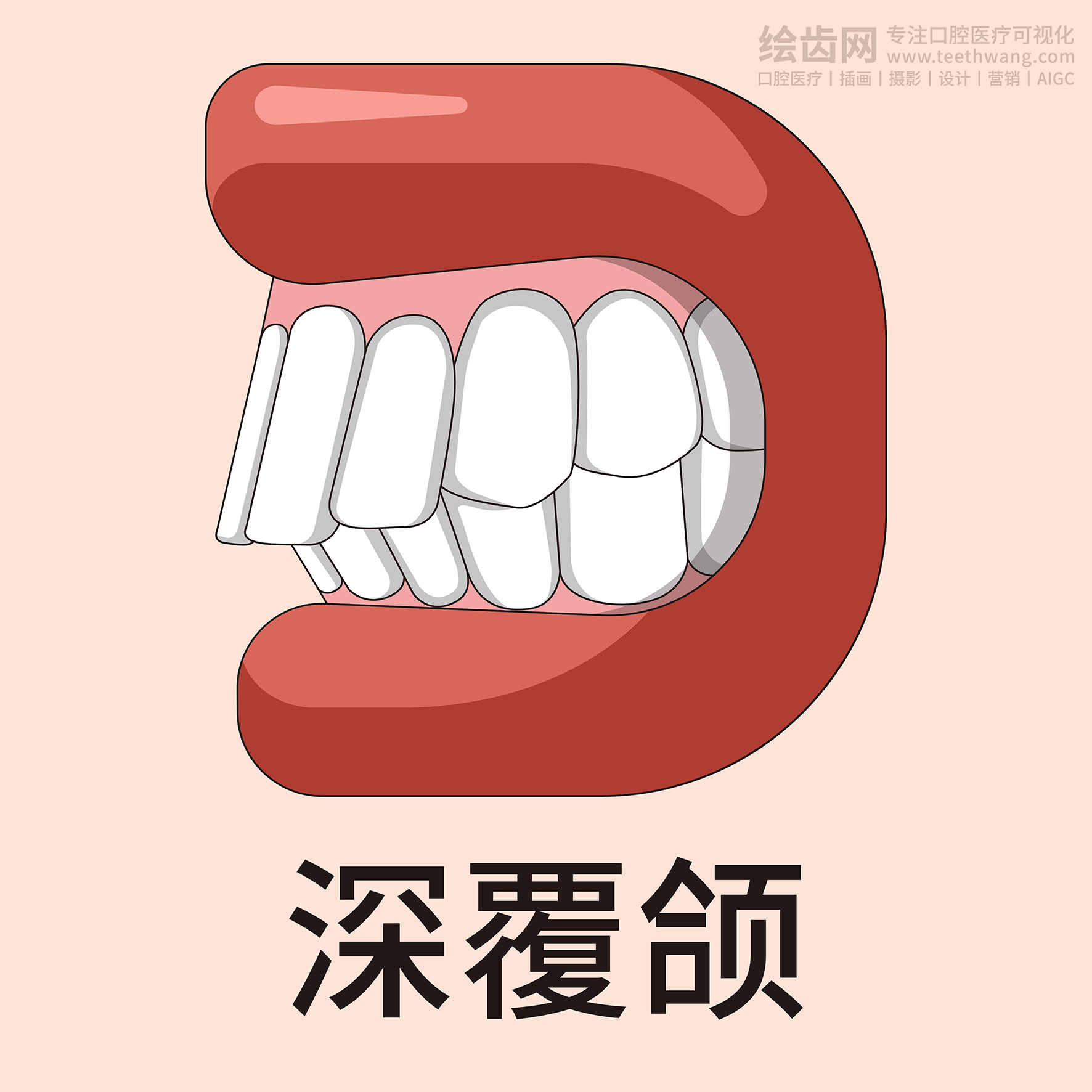 牙齿类型大全（合集-黄色背景）牙齿矫正 种植 贴面