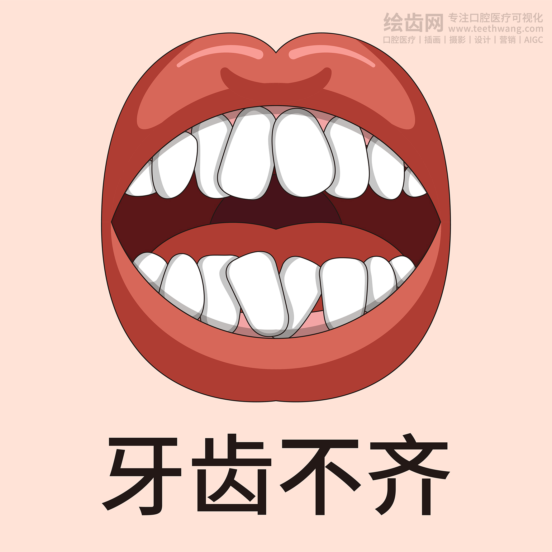 牙齿类型大全（合集-黄色背景）牙齿矫正 种植 贴面