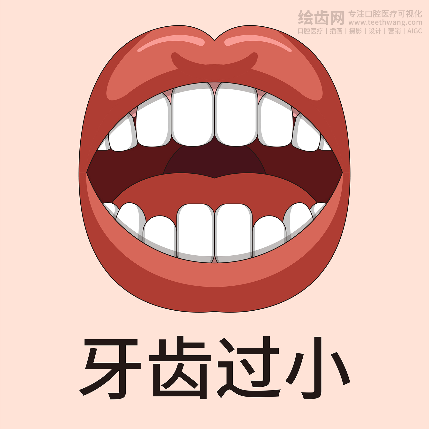 牙齿类型大全（合集-黄色背景）牙齿矫正 种植 贴面