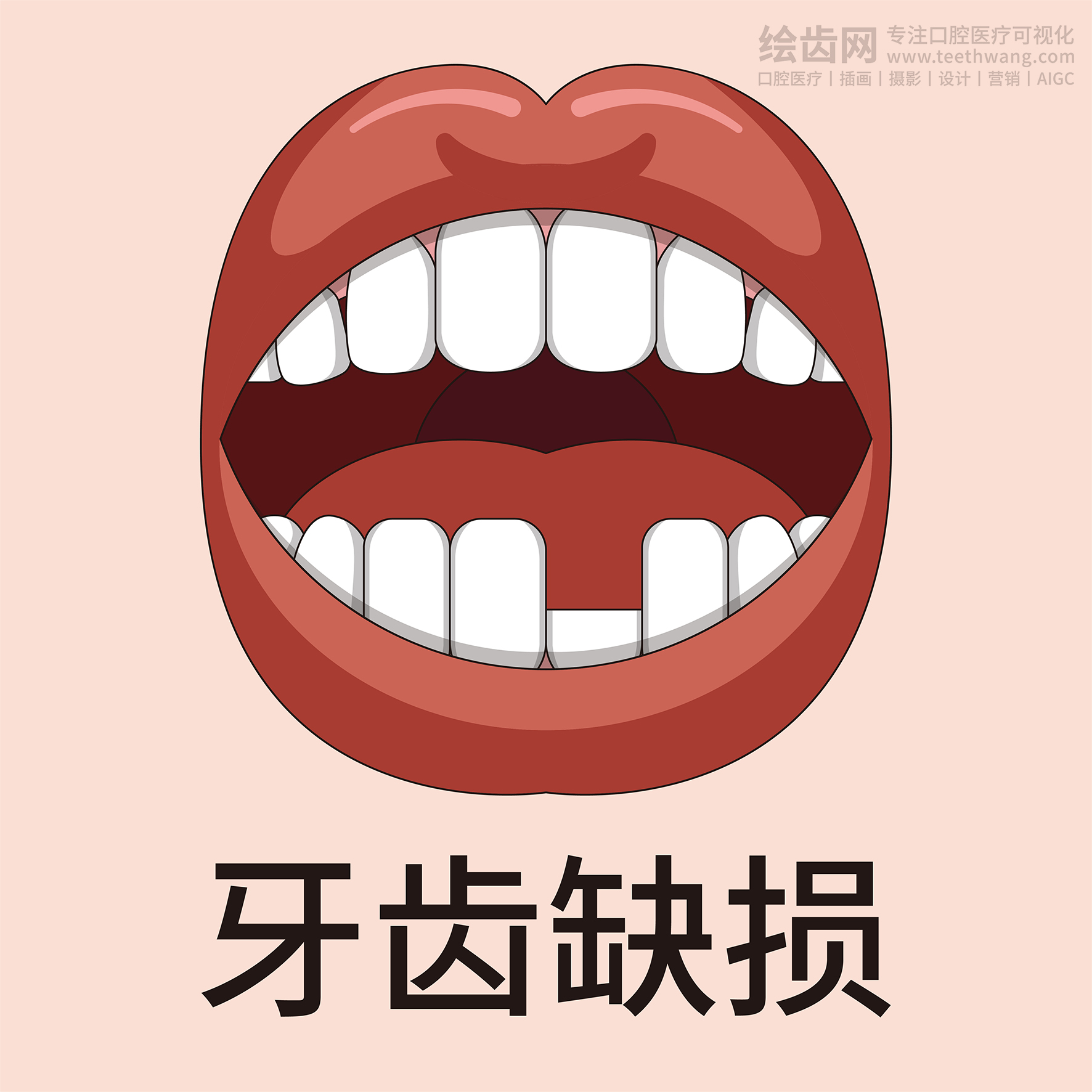 牙齿类型大全（合集-黄色背景）牙齿矫正 种植 贴面