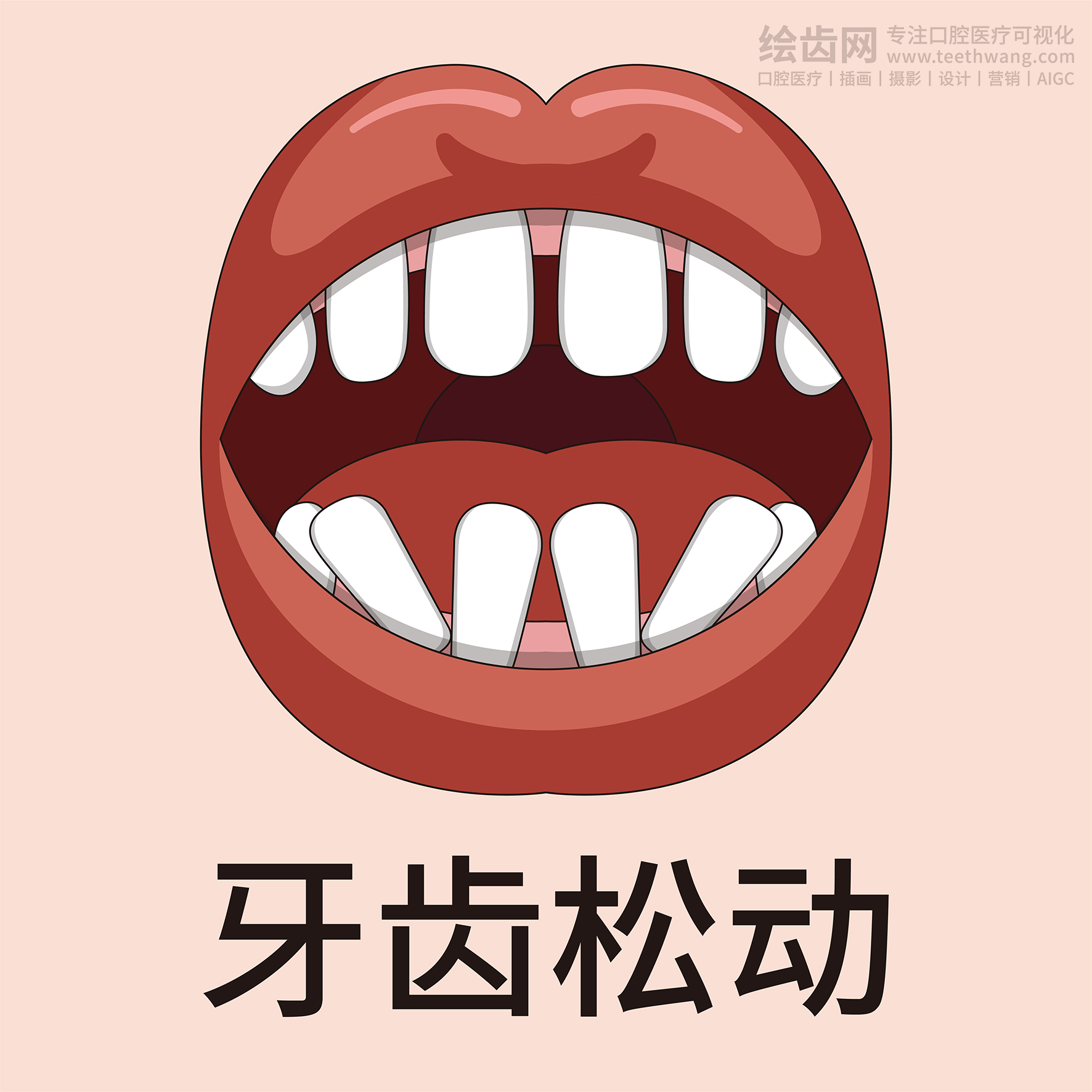 牙齿类型大全（合集-黄色背景）牙齿矫正 种植 贴面