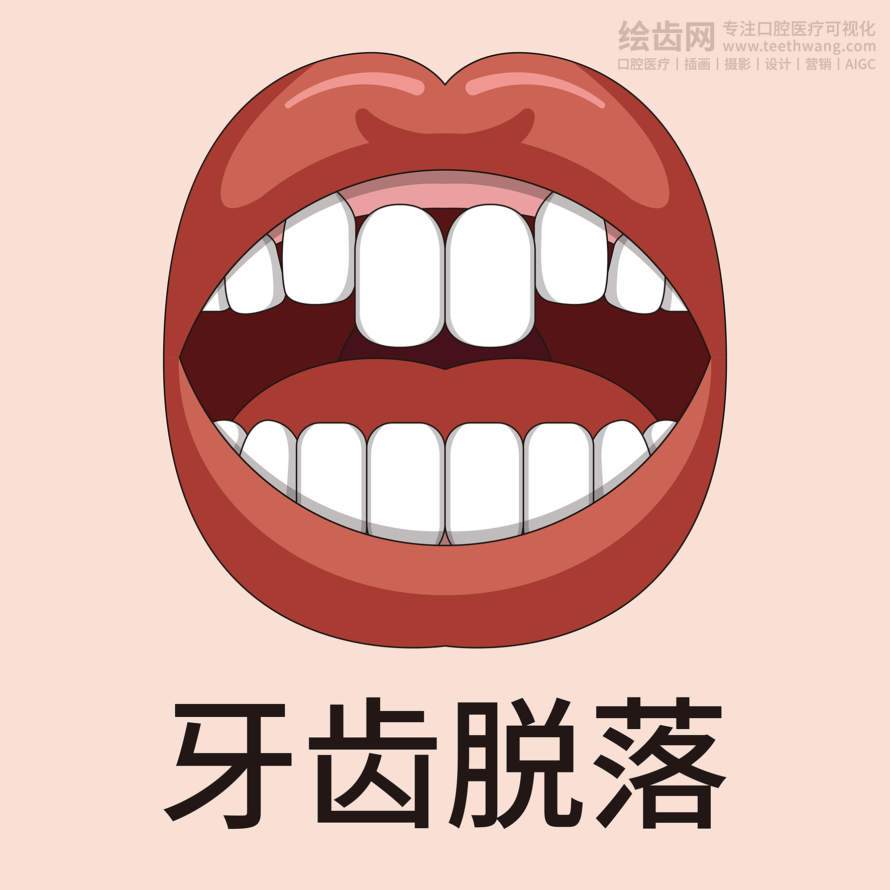 牙齿类型大全（合集-黄色背景）牙齿矫正 种植 贴面