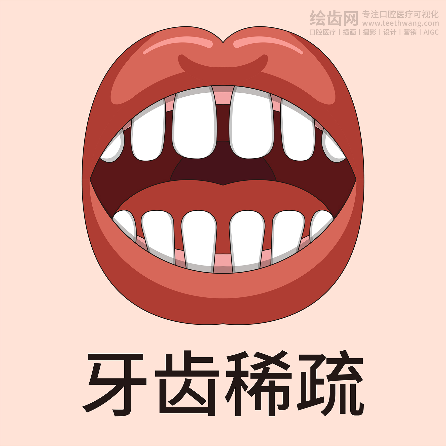 牙齿类型大全（合集-黄色背景）牙齿矫正 种植 贴面