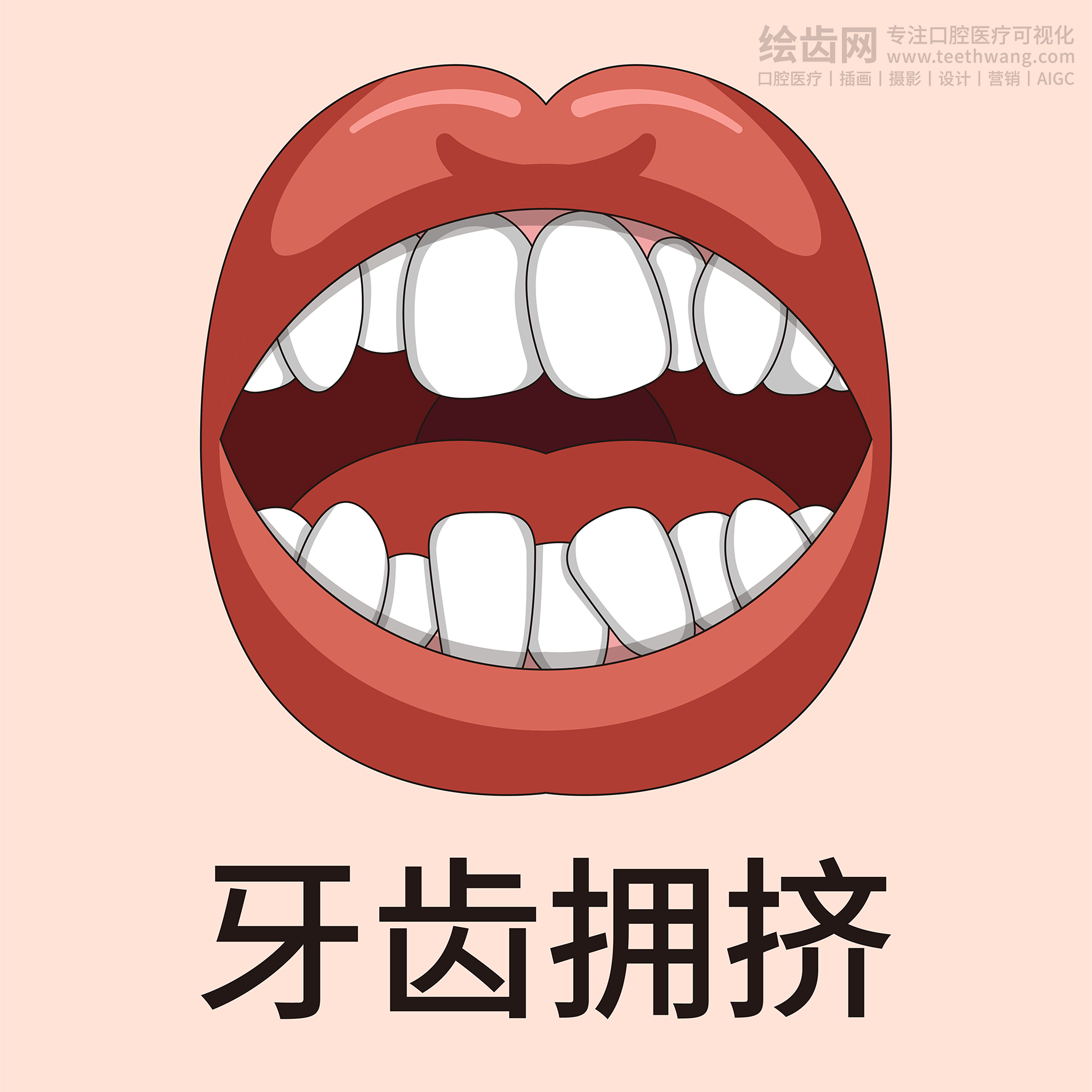 牙齿类型大全（合集-黄色背景）牙齿矫正 种植 贴面