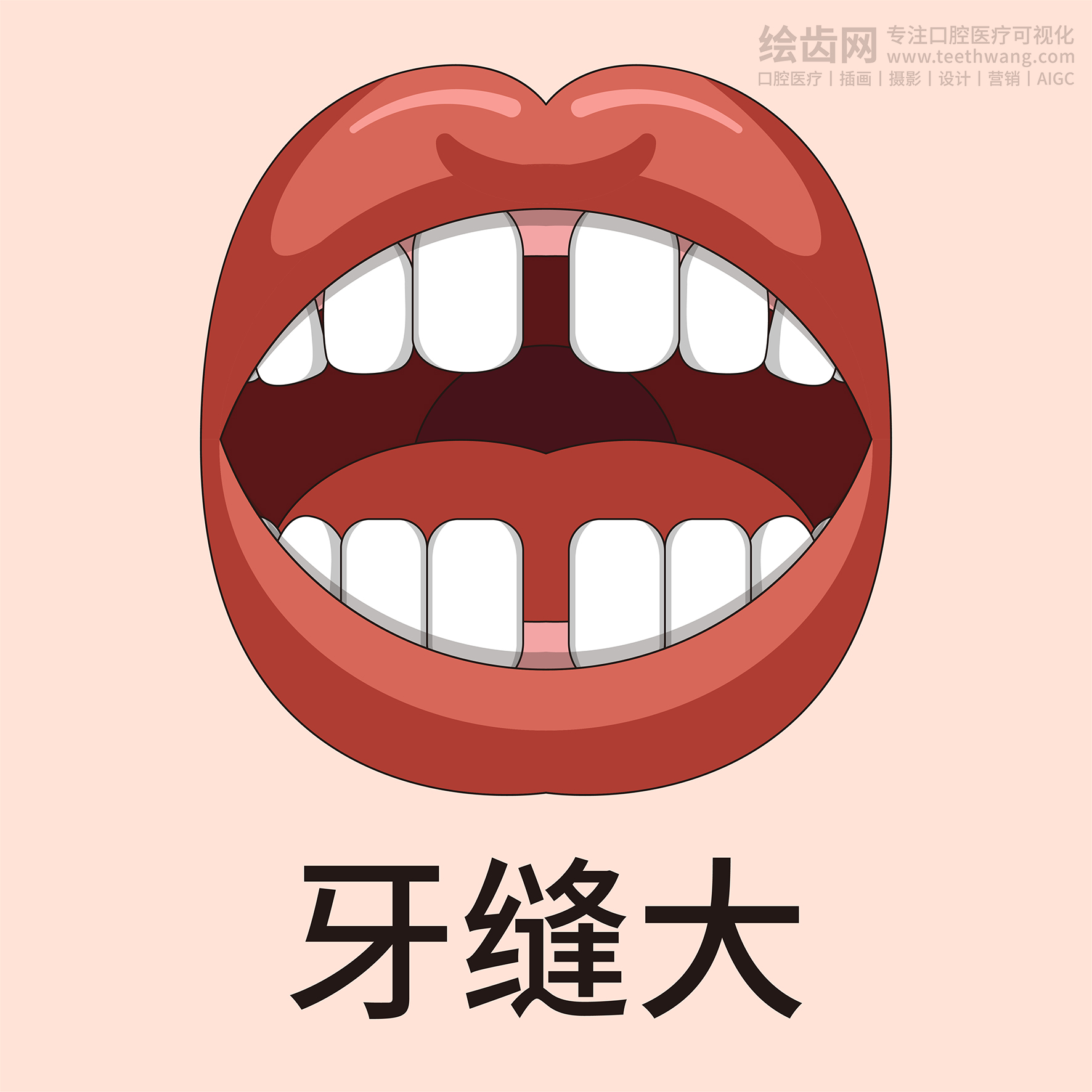 牙齿类型大全（合集-黄色背景）牙齿矫正 种植 贴面