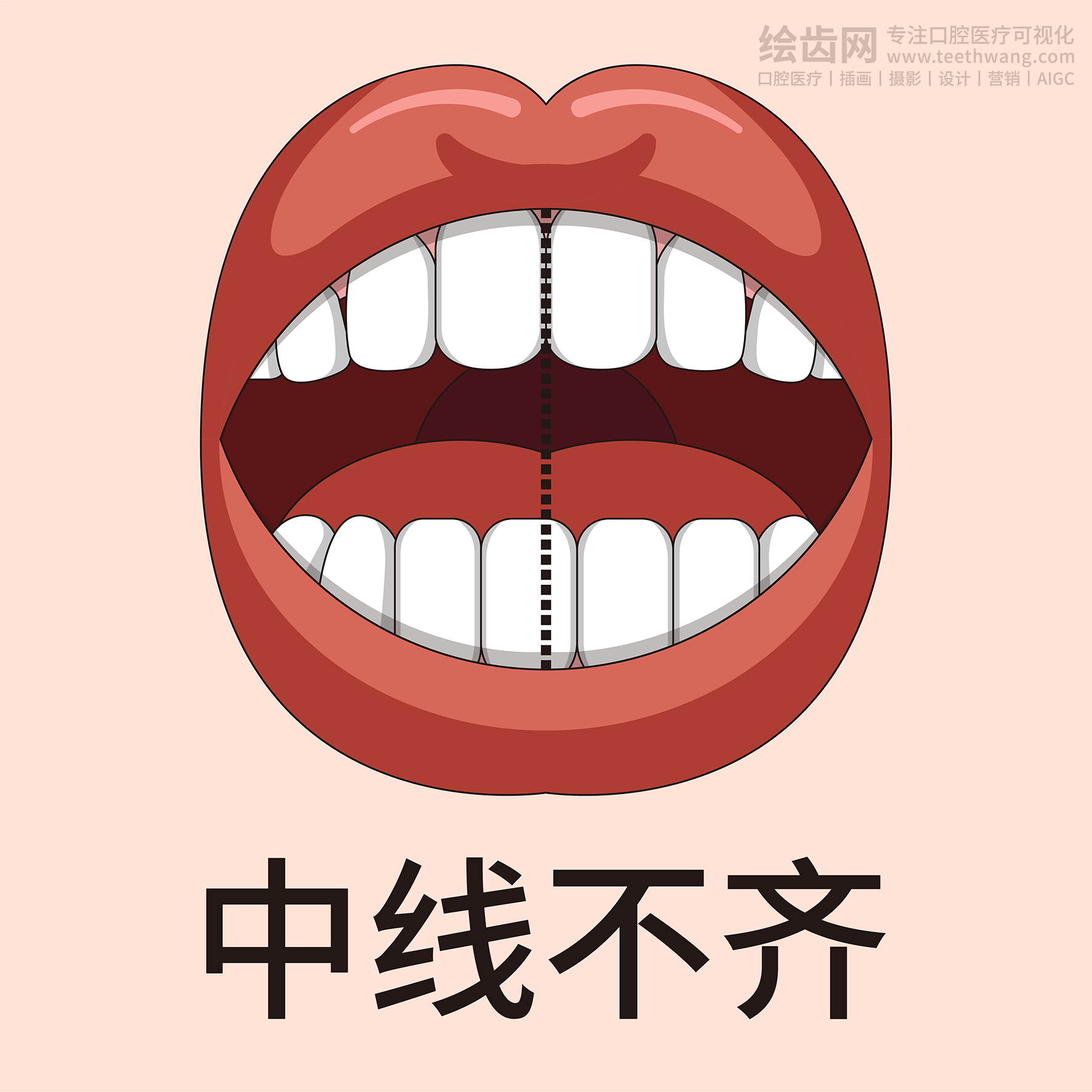 牙齿类型大全（合集-黄色背景）牙齿矫正 种植 贴面