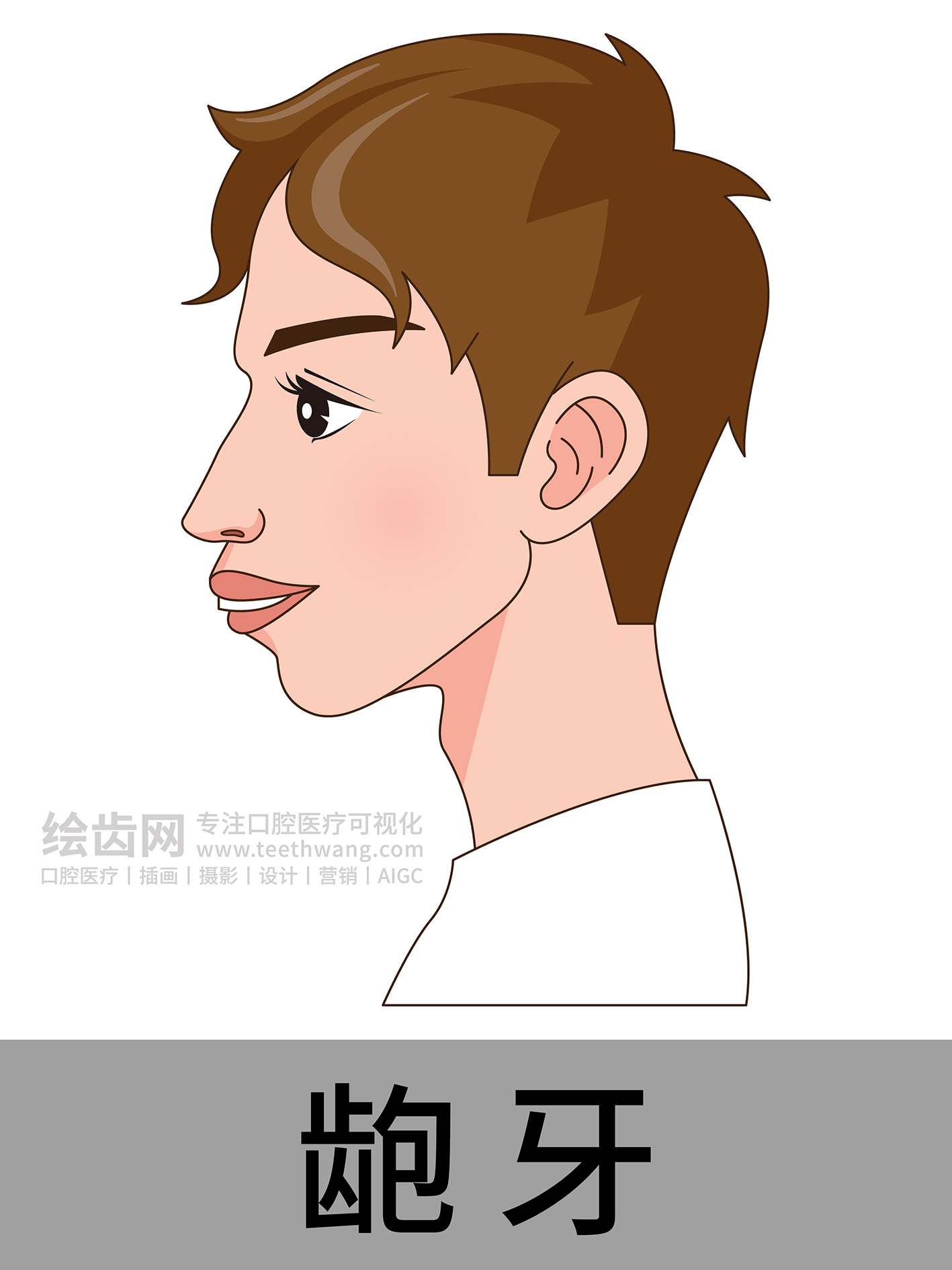 男孩侧脸 牙齿矫正类型 口腔医美插画